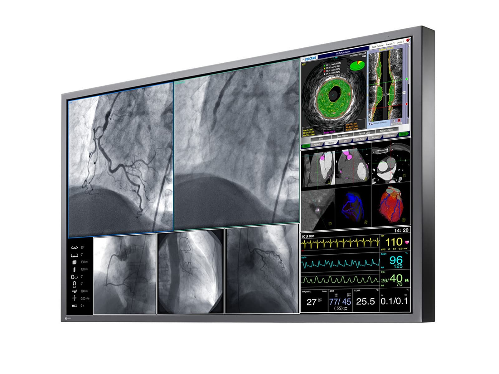 Monitor Médico Eizo LX600W 8MP – 60.1" – Uso Quirúrgico DICOM (2)