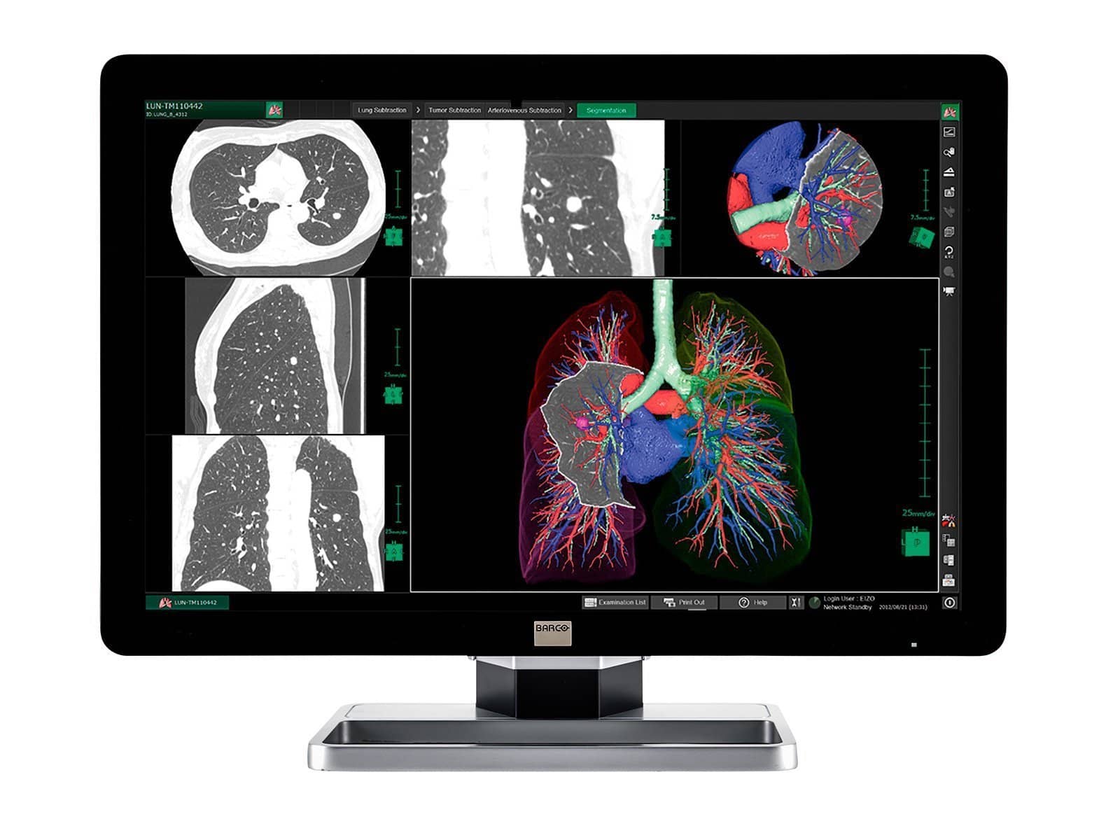 Monitor Médico Barco MDCC-6130 6MP – 30" – Color – Radiología Diagnóstica DICOM (1)