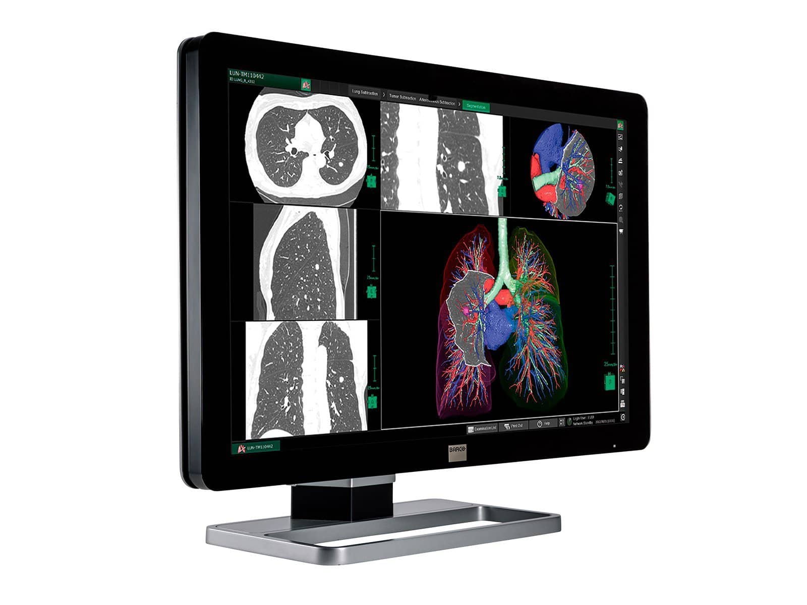 Monitor Médico Barco MDCC-6130 6MP – 30" – Color – Radiología Diagnóstica DICOM (2)