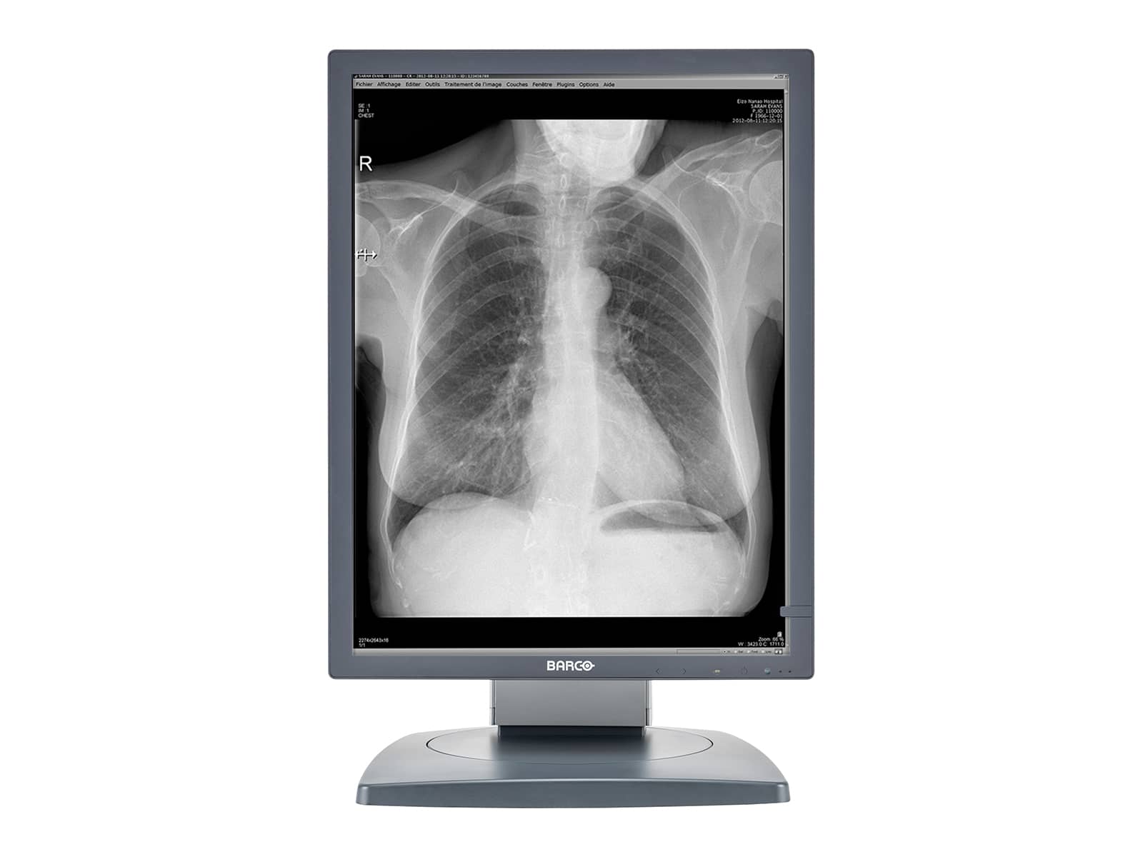 Monitor Médico Barco MDCG-3120 3MP – 20.8" – Escala de grises – Radiología Diagnóstica DICOM (5)