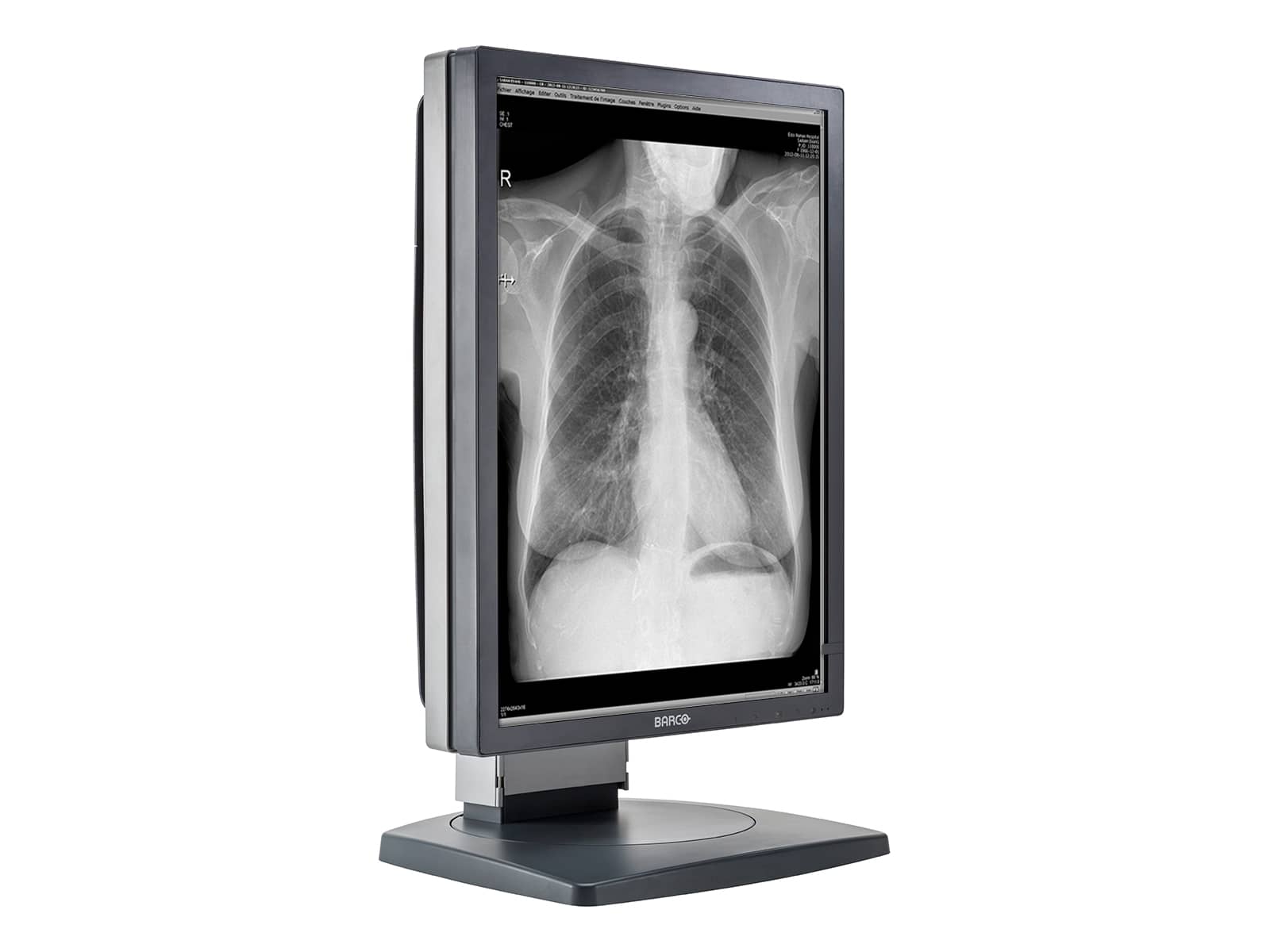 Monitor Médico Barco MDCG-3120 3MP – 20.8" – Escala de grises – Radiología Diagnóstica DICOM (6)