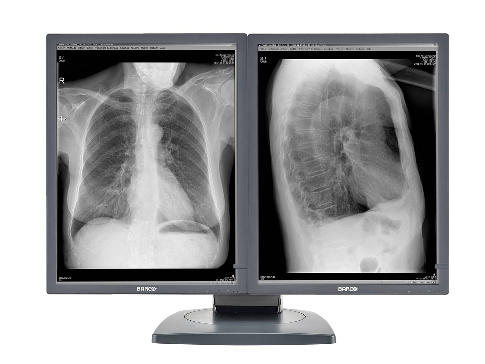 Monitor Médico Barco MDCG-3120 3MP – 20.8" – Escala de grises – Radiología Diagnóstica DICOM (3)