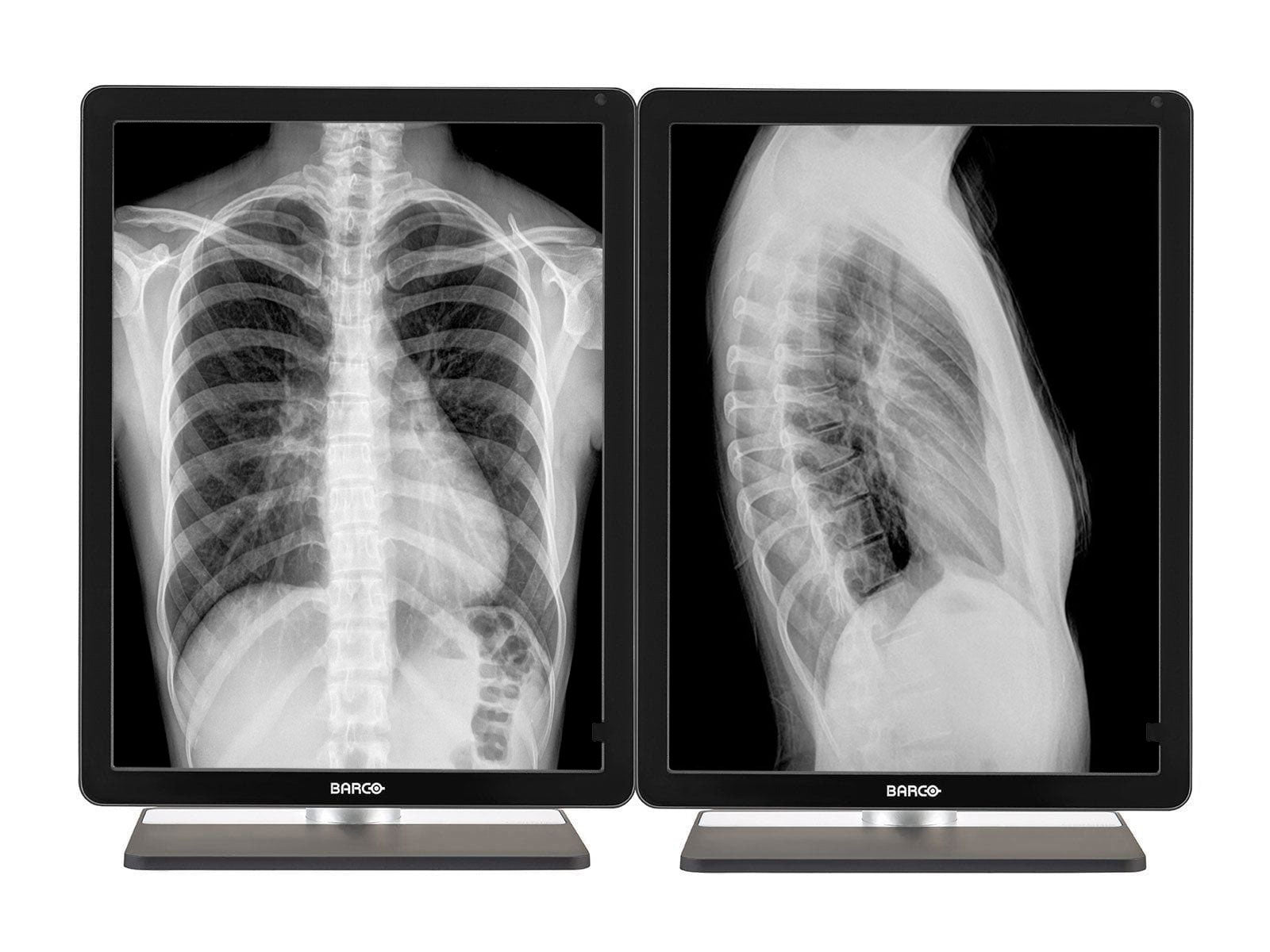Monitor Médico Barco MDCG-3221 3MP – 21.3" – Escala de grises – Radiología Diagnóstica DICOM (1)
