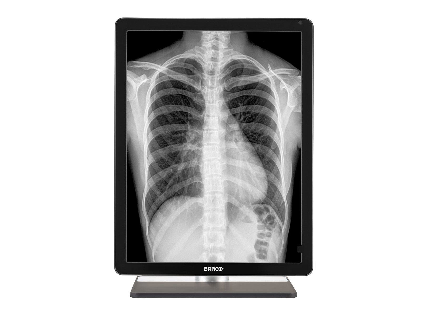 Monitor Médico Barco MDCG-3221 3MP – 21.3" – Escala de grises – Radiología Diagnóstica DICOM (3)