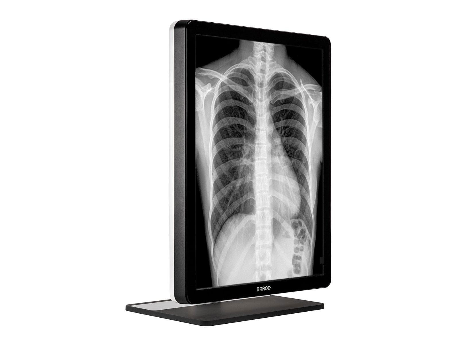Monitor Médico Barco MDCG-3221 3MP – 21.3" – Escala de grises – Radiología Diagnóstica DICOM (4)
