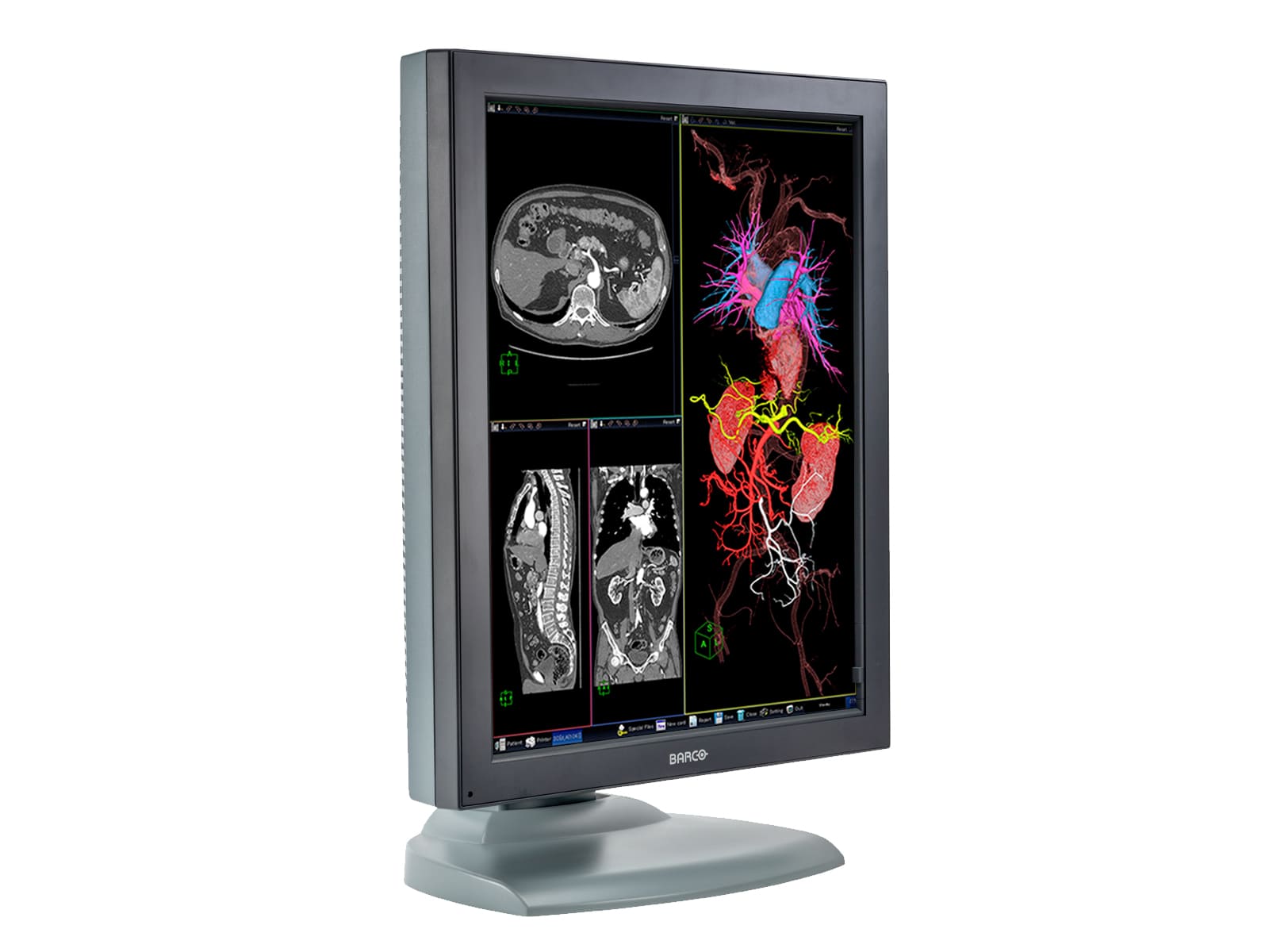 Monitor Médico Barco MDNC-3121 3MP – 21" – Color – Radiología Diagnóstica DICOM (4)