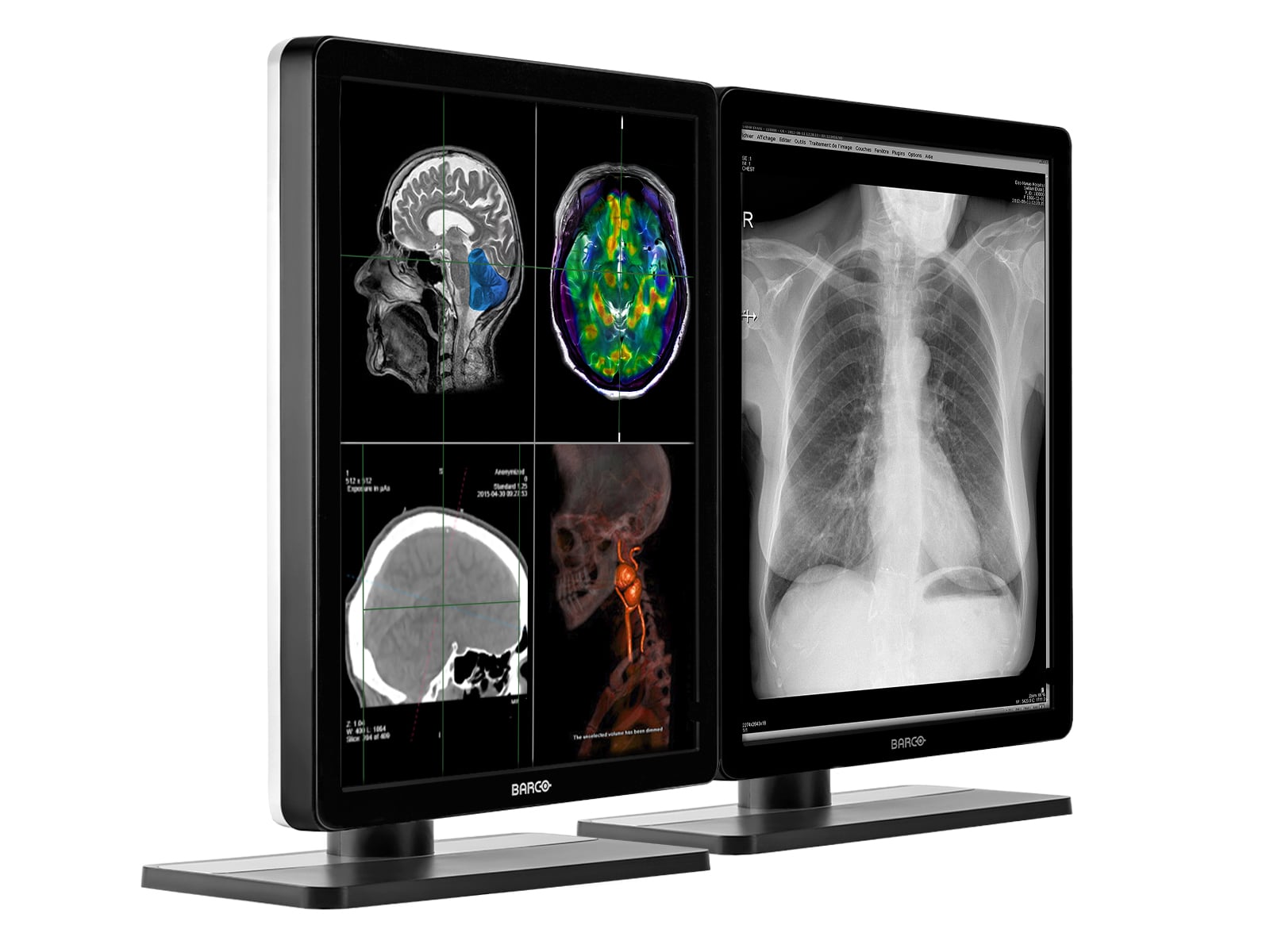 Monitor Médico Barco MDNC-2221 2MP – 21" – Color – Radiología Diagnóstica DICOM (2)