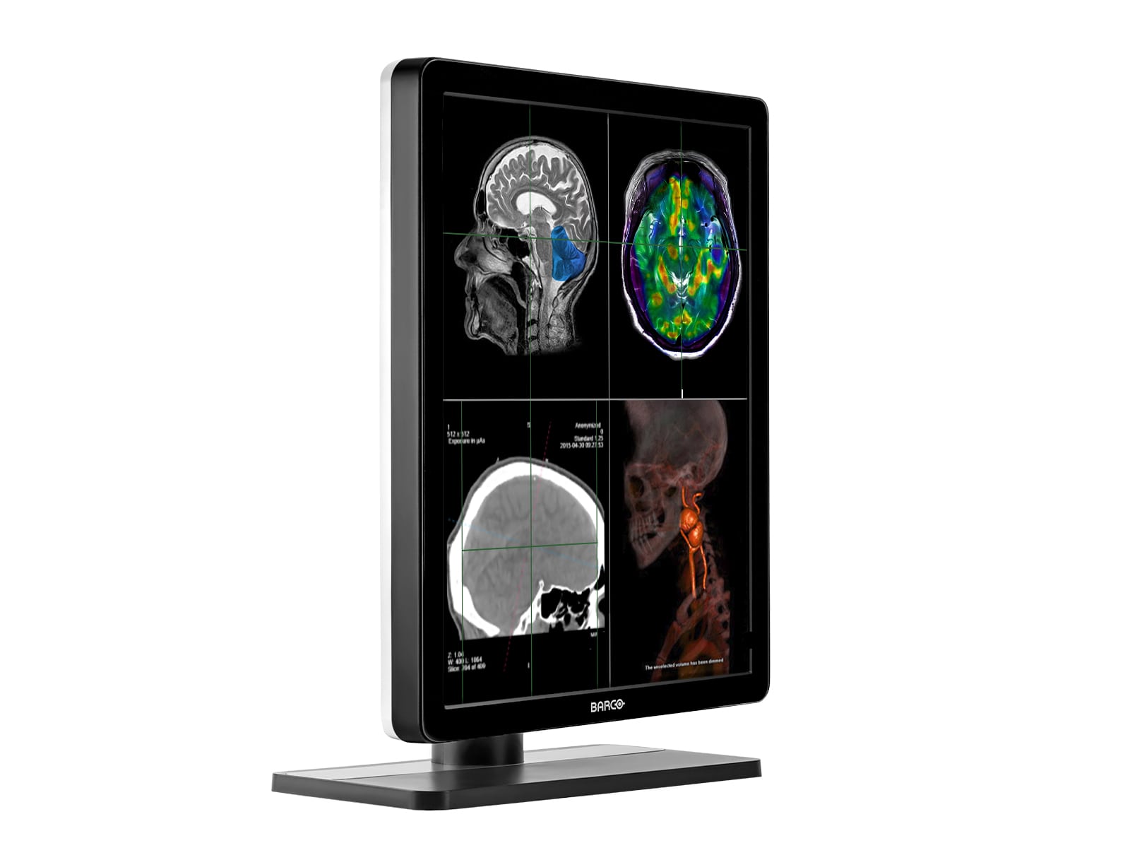 Monitor Médico Barco MDNC-2221 2MP – 21" – Color – Radiología Diagnóstica DICOM (4)