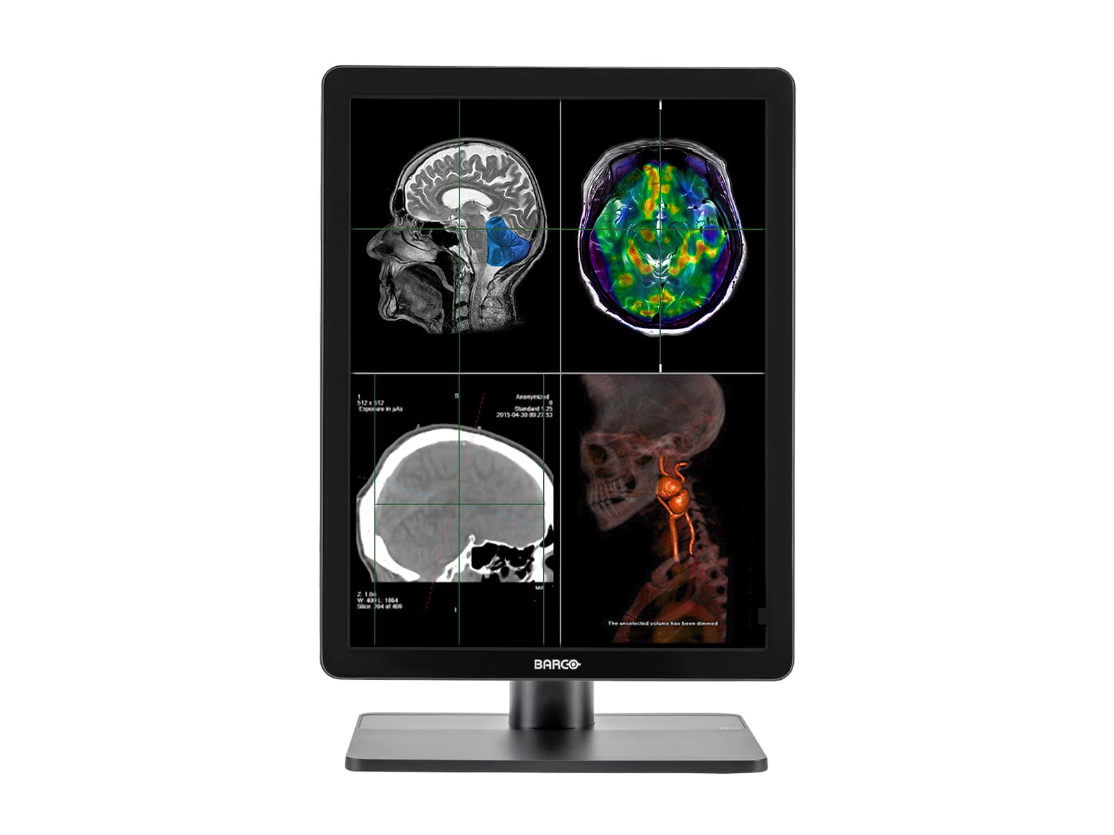 Monitor Médico Barco MDNC-2221 2MP – 21" – Color – Radiología Diagnóstica DICOM (3)