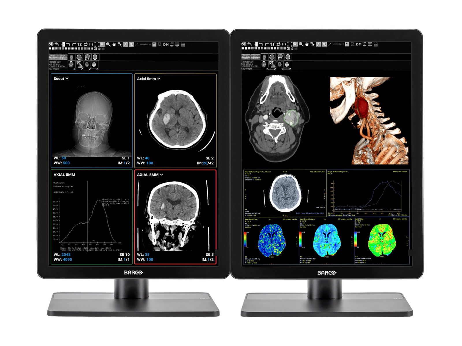 Monitor Médico Barco MDNC-3421 3MP – 21.3" – Color – Radiología Diagnóstica DICOM (7)