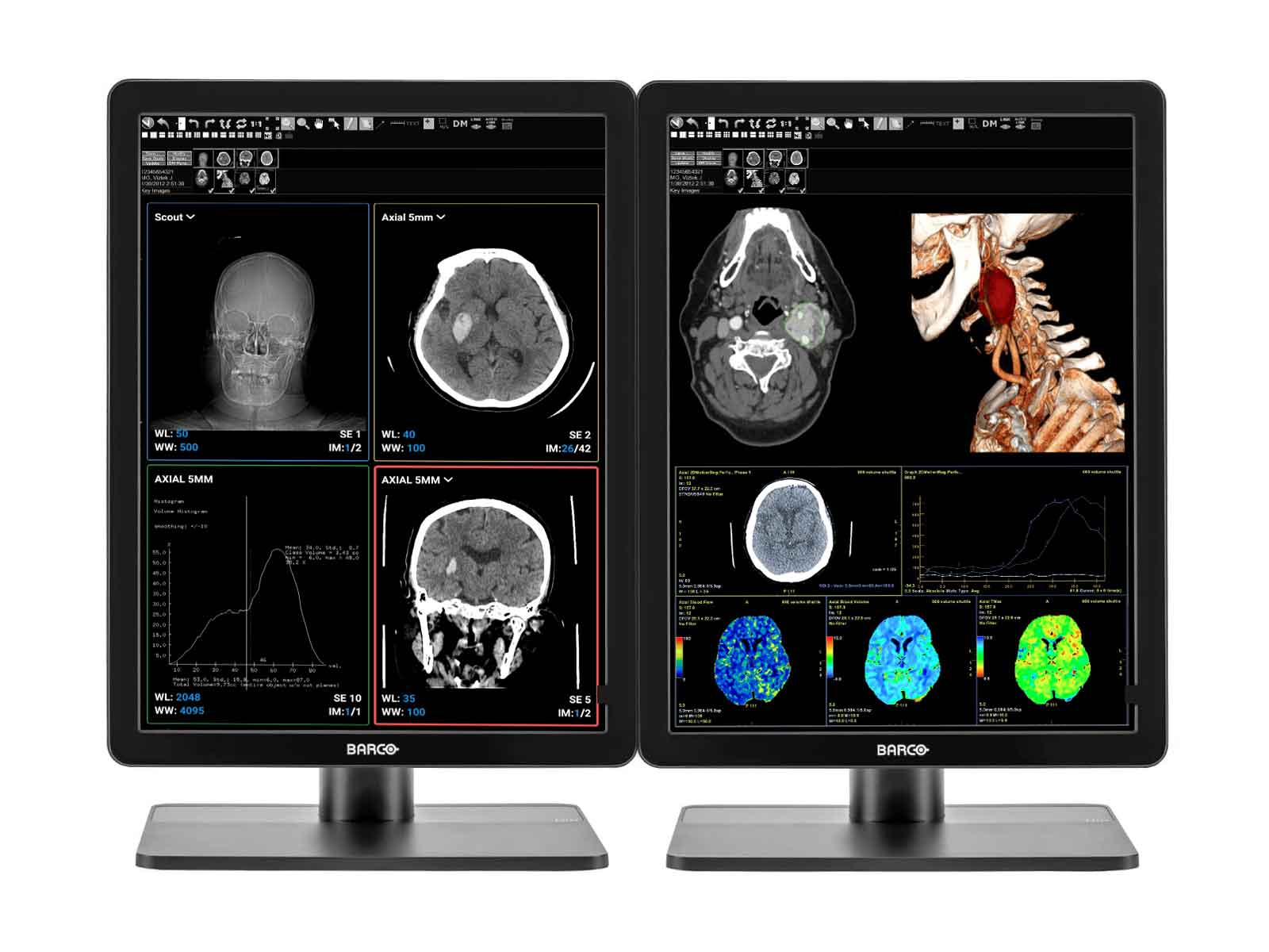 Monitor Médico Barco MDNC-3421 3MP – 21.3" – Color – Radiología Diagnóstica DICOM (6)