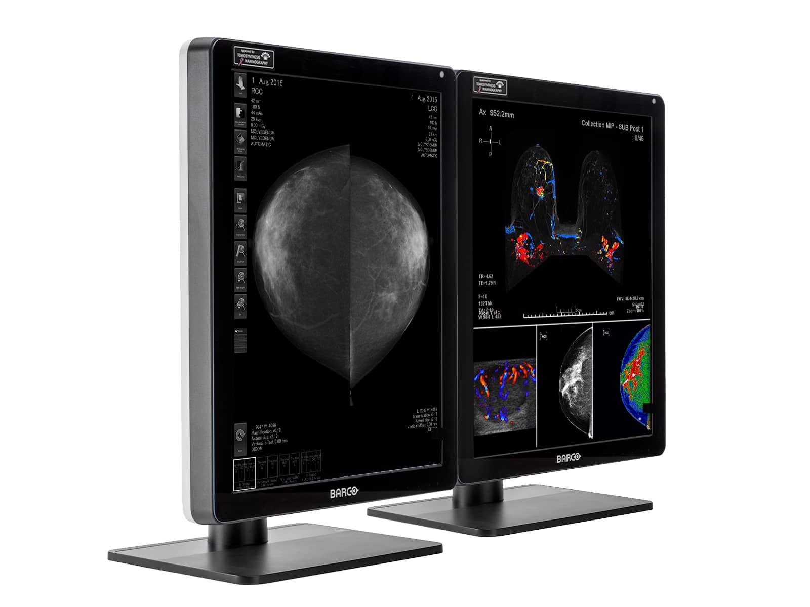 Monitor Médico Barco MDNC-6121 5MP – 21.3" – Color – Radiología Diagnóstica DICOM (2)