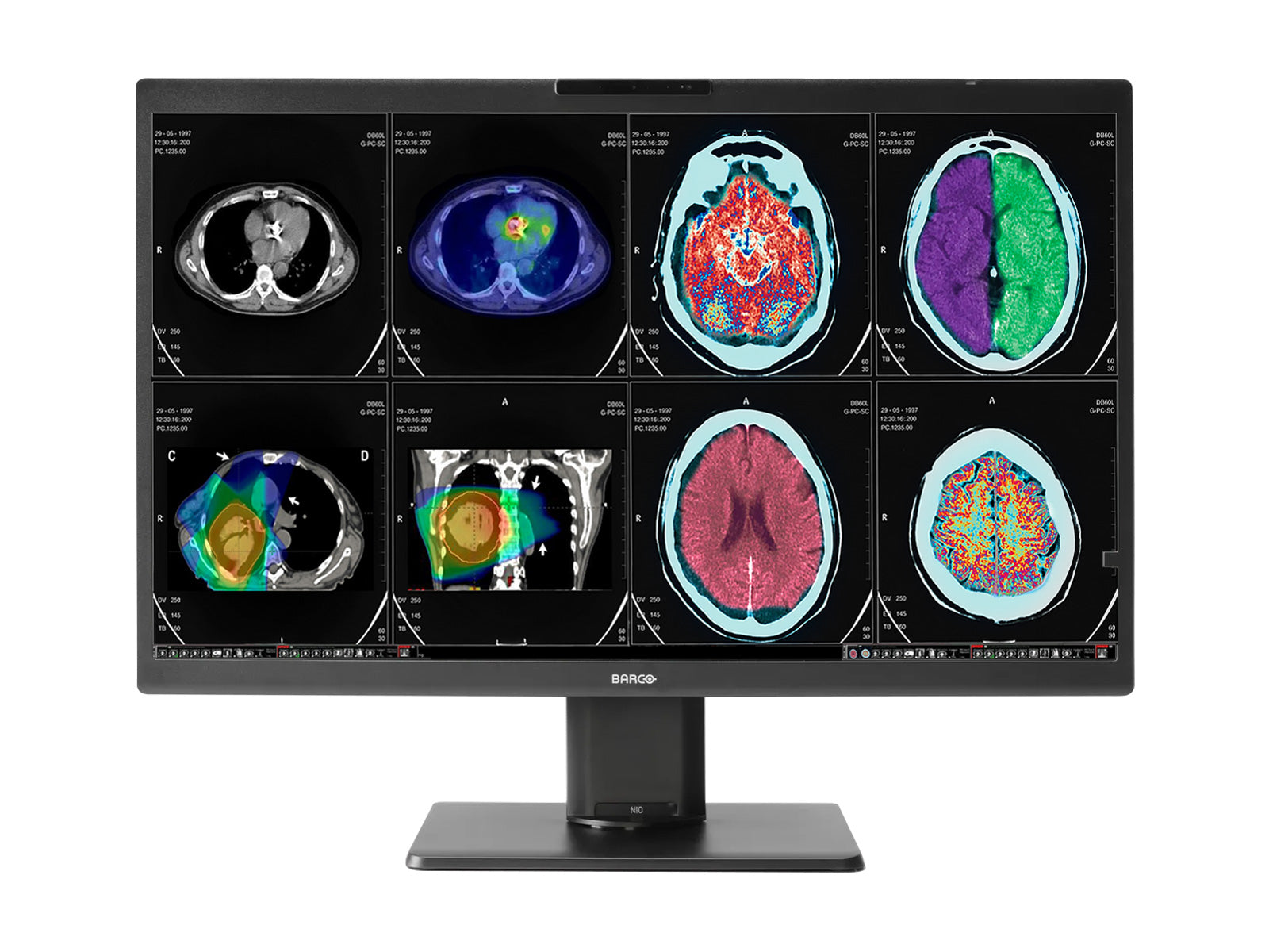 Monitor Médico Barco MDNC-8132 8MP – 32" – Color – Radiología Diagnóstica DICOM (1)