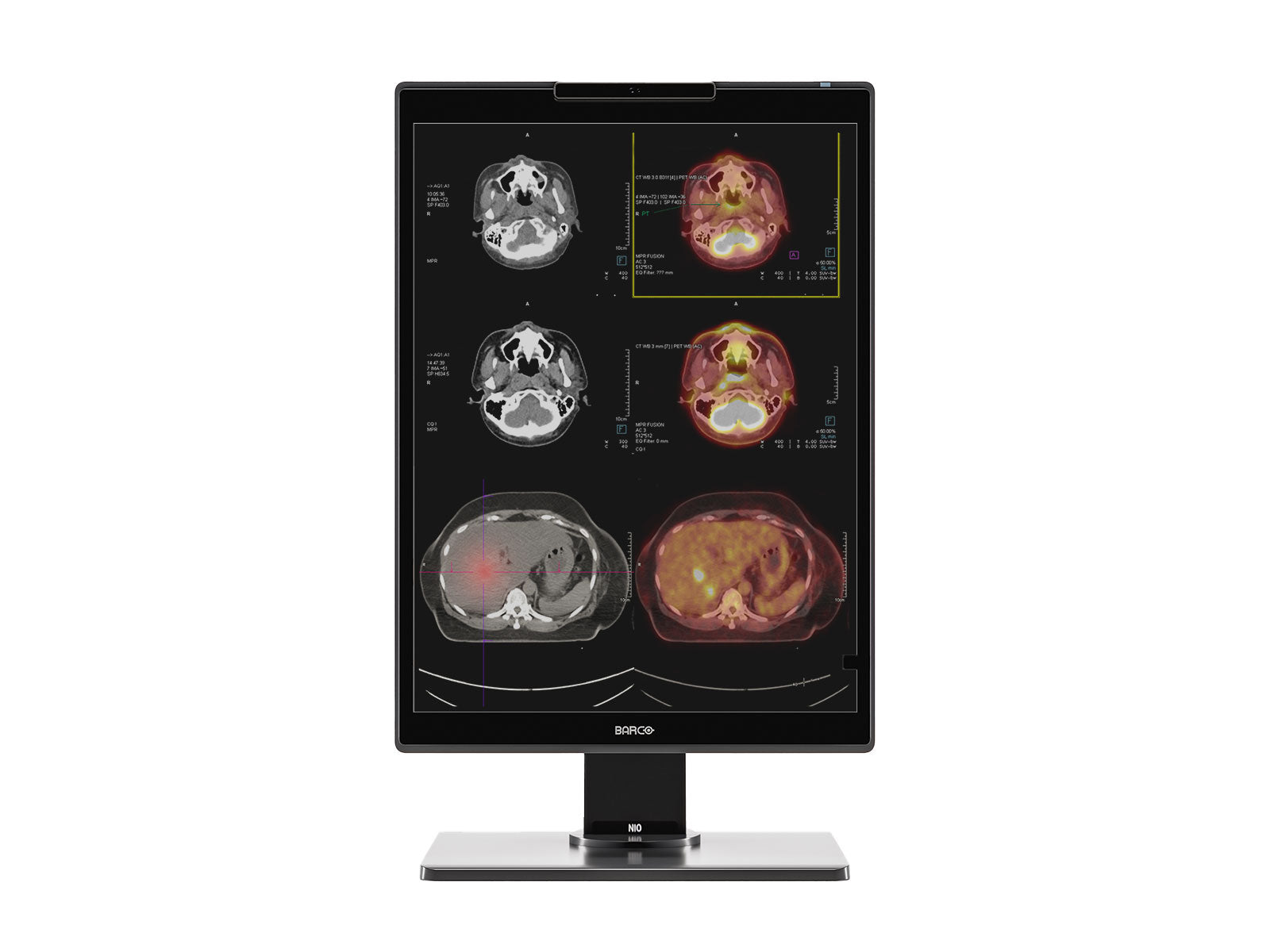 Monitor Médico Barco MDNC-2521 2MP – 21" – Color – Radiología Diagnóstica (1)
