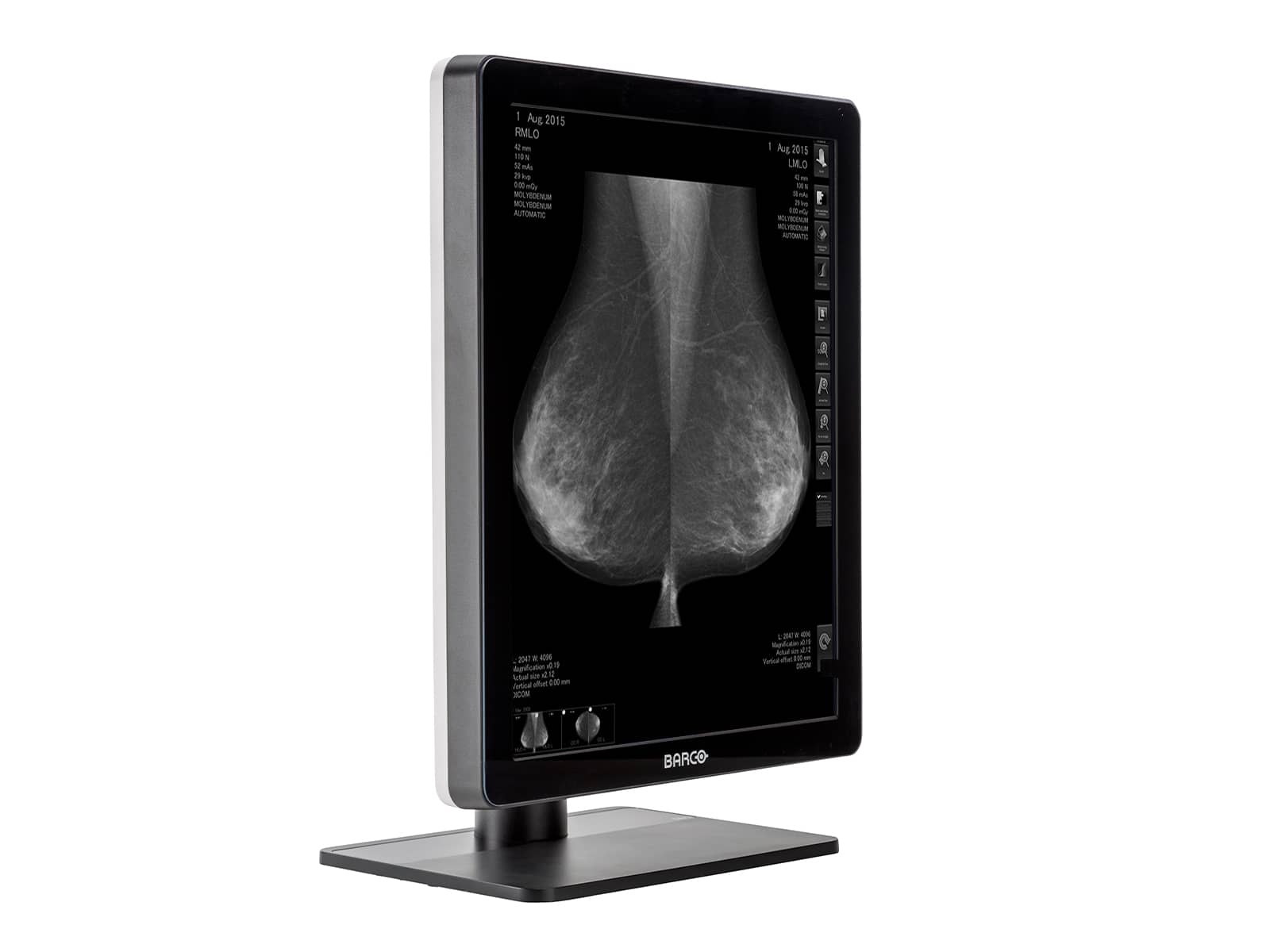 Monitor Médico Barco MDNG-5221 5MP – 21.3" – Escala de grises – Radiología Diagnóstica DICOM (4)