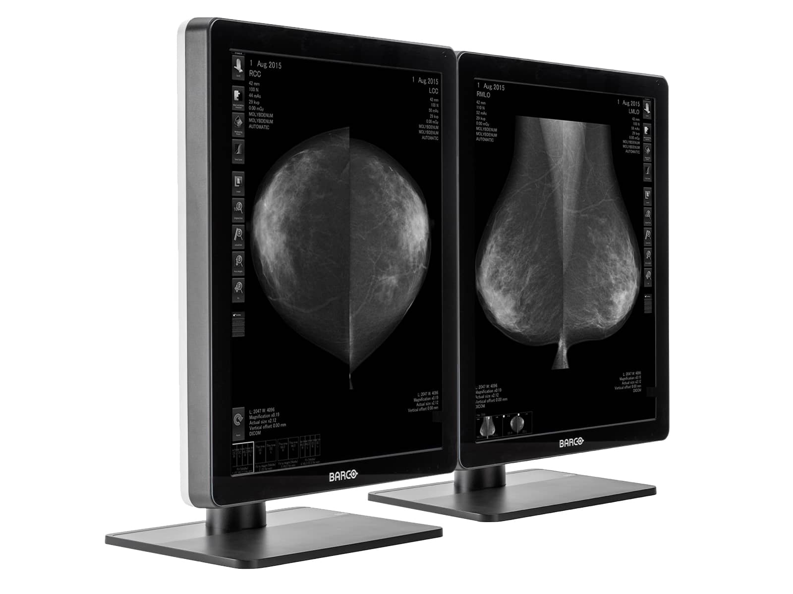 Monitor Médico Barco MDNG-5221 5MP – 21.3" – Escala de grises – Radiología Diagnóstica DICOM (2)