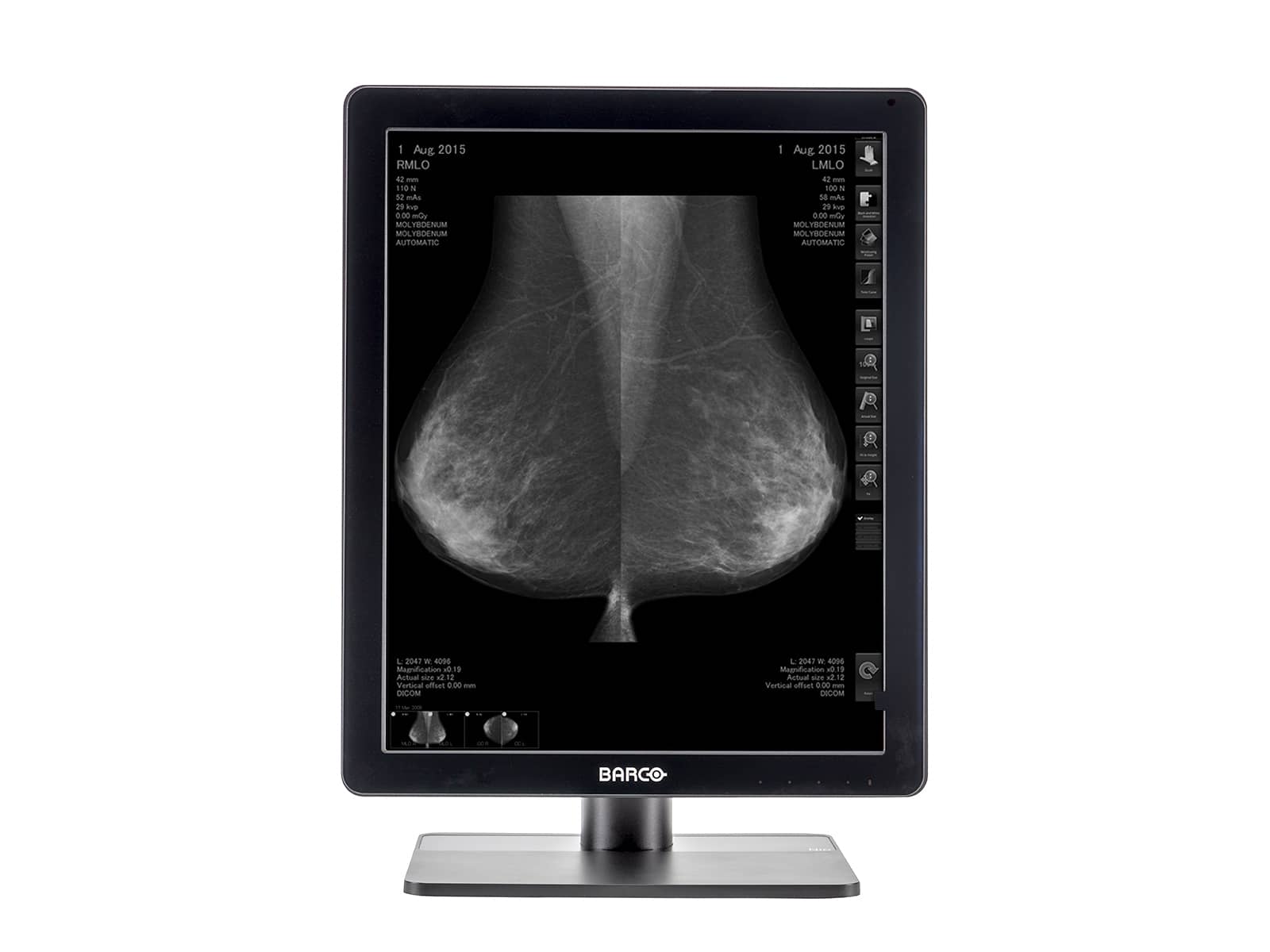 Monitor Médico Barco MDNG-5221 5MP – 21.3" – Escala de grises – Radiología Diagnóstica DICOM (3)