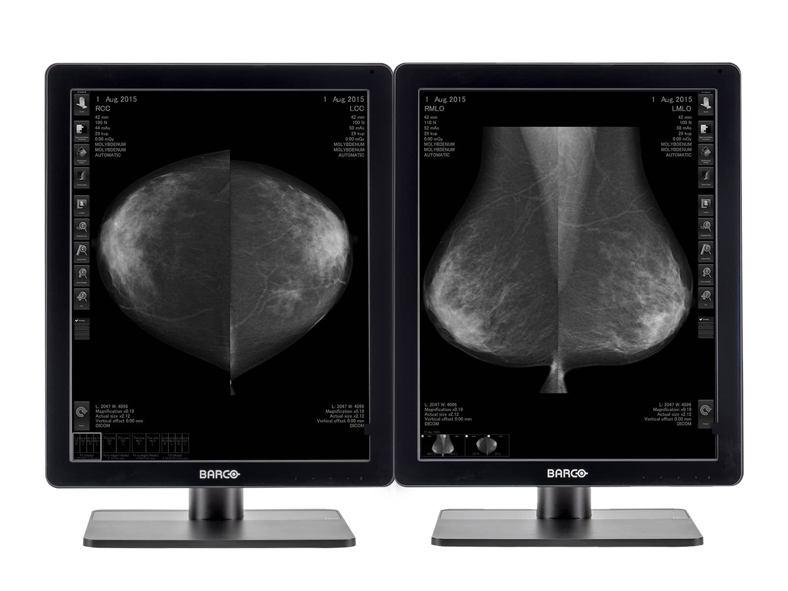 Monitor Médico Barco MDNG-5221 5MP – 21.3" – Escala de grises – Radiología Diagnóstica DICOM (1)