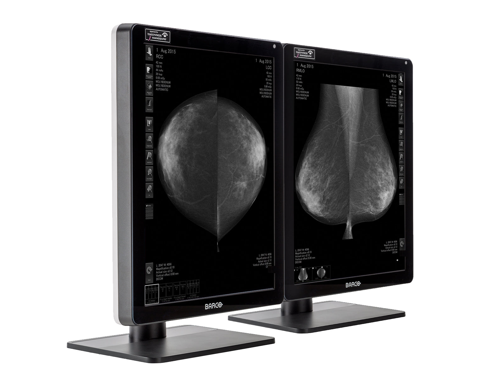 Monitor Médico Barco MDNG-6221 5MP – 21" – Escala de grises – Radiología Diagnóstica DICOM (2)