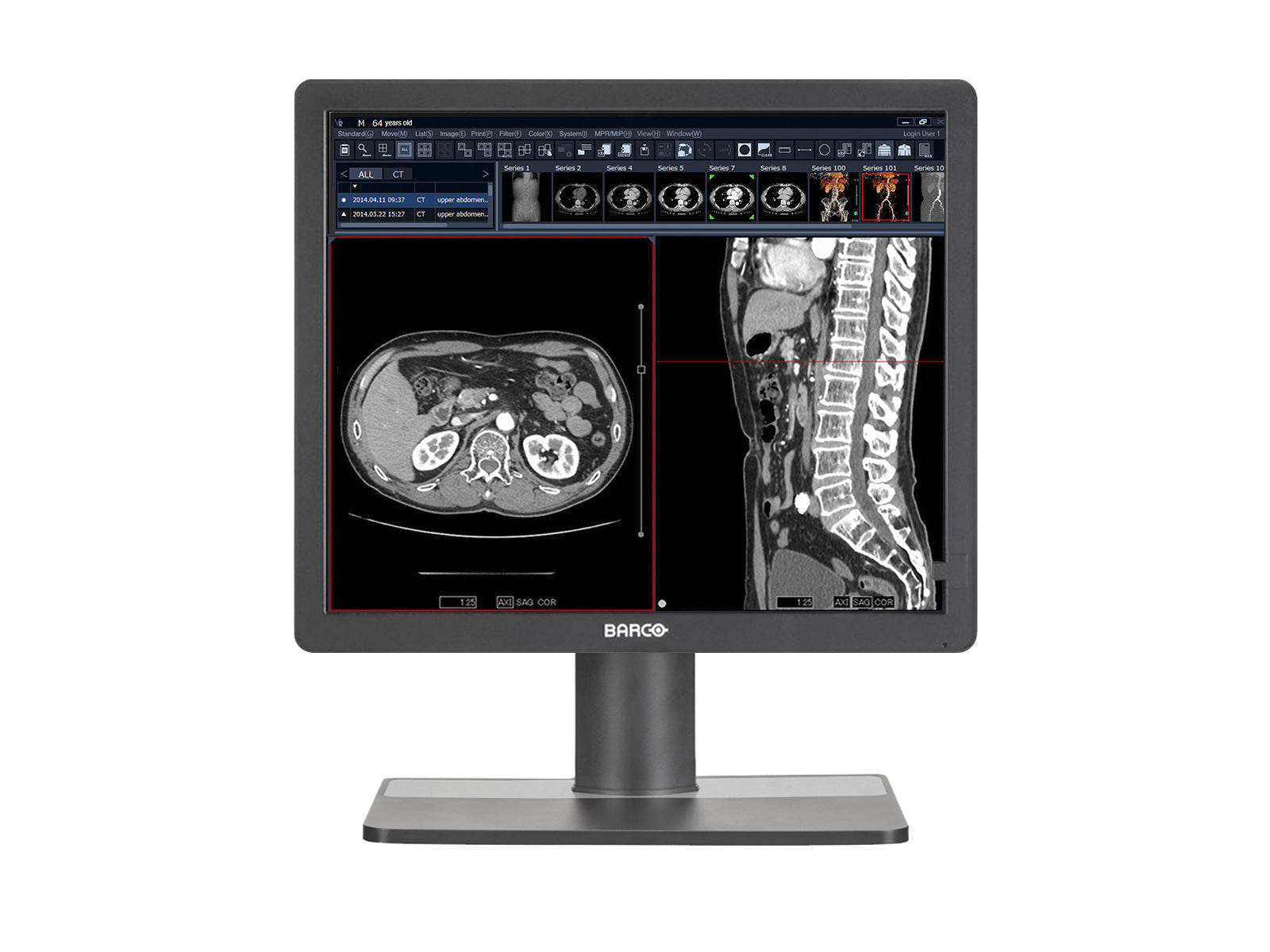 Monitor Médico Barco MDRC-1219 1MP – 19" – Color – Revisión Clínica DICOM (1)