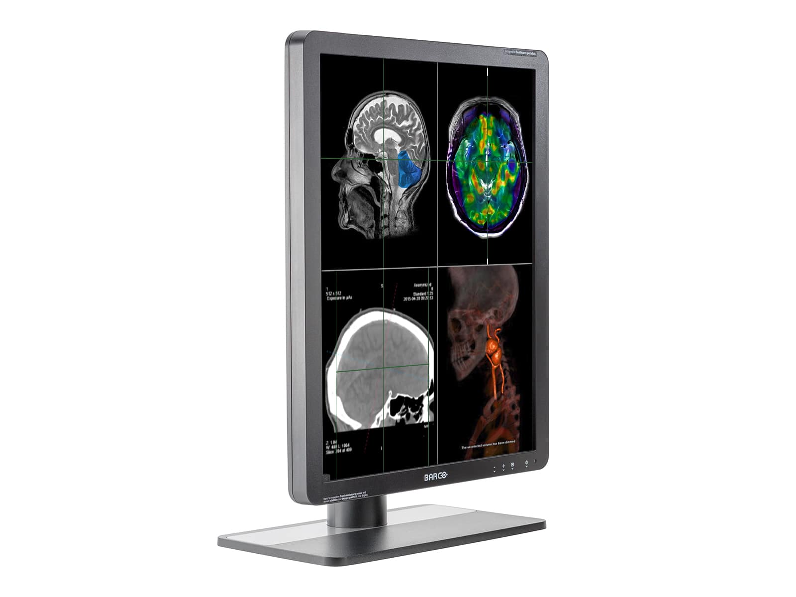 Monitor Médico Barco MDRC-2221 2MP – 21" – Radiología Diagnóstica DICOM (3)