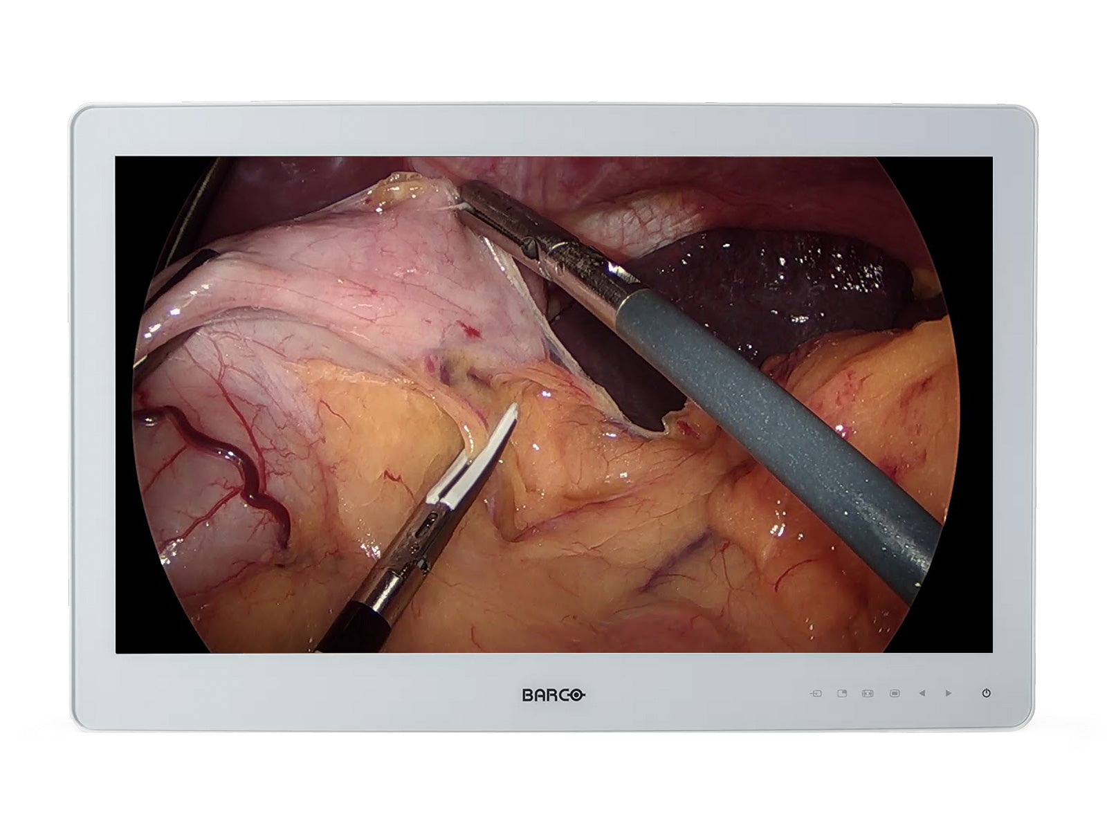 Monitor Médico Barco MDSC-2326 2MP – 26" – Uso Quirúrgico (1)