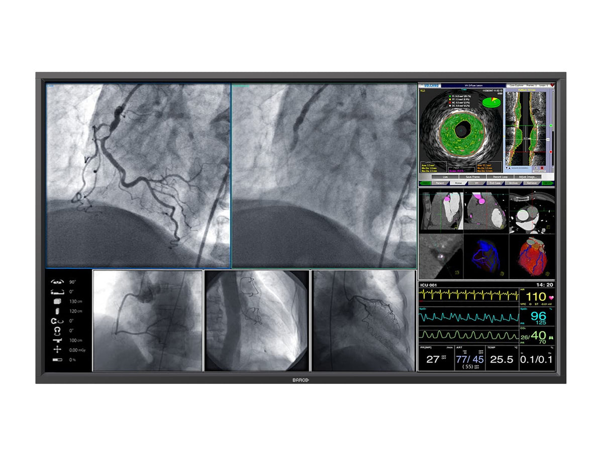 Monitor Médico Barco MDSC-8258 8MP – 58" – Uso Quirúrgico DICOM (1)