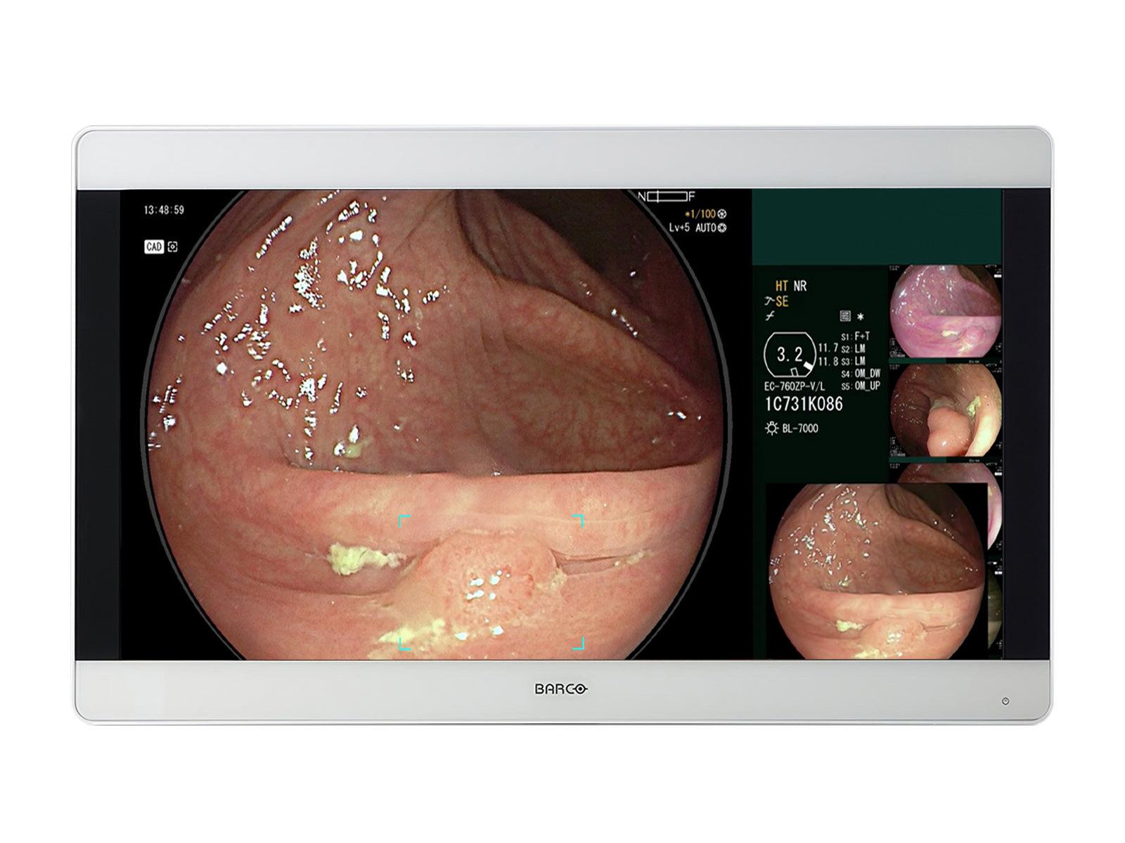 Monitor Médico Barco MDSC-8331 8MP – Uso Quirúrgico DICOM (1)