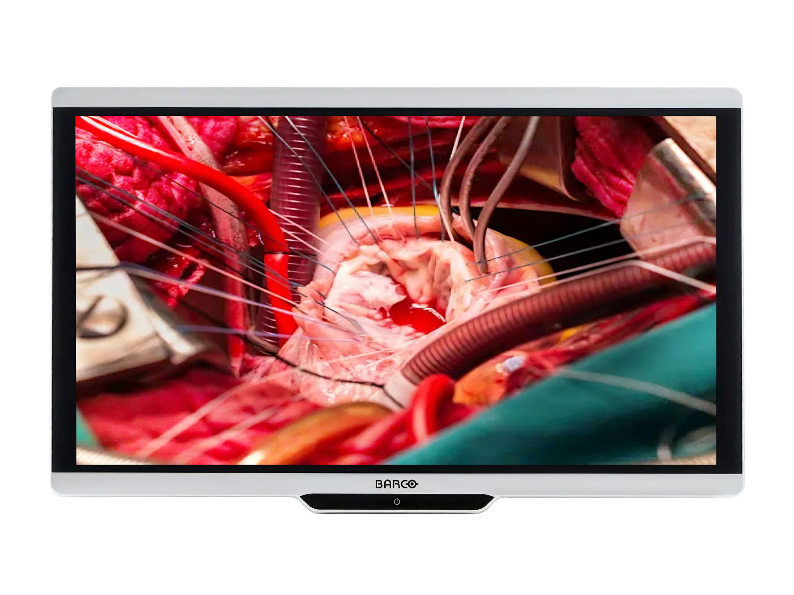 Monitor Médico Barco MDSC-8427 8MP – 27" – Uso Quirúrgico (1)