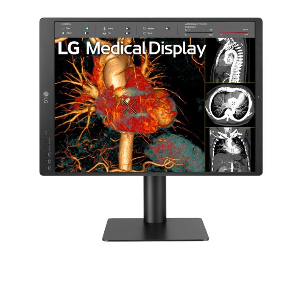 MONITOR-LG-DE-DIAGNOSTICO-21.3-IPS-3MP-MULTI-RESOLUCION-front