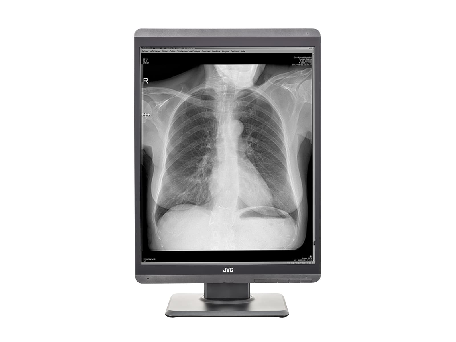 Monitor Médico JVC MS-S300 3MP – 21.3" – Escala de grises – Radiología Diagnóstica DICOM (4)