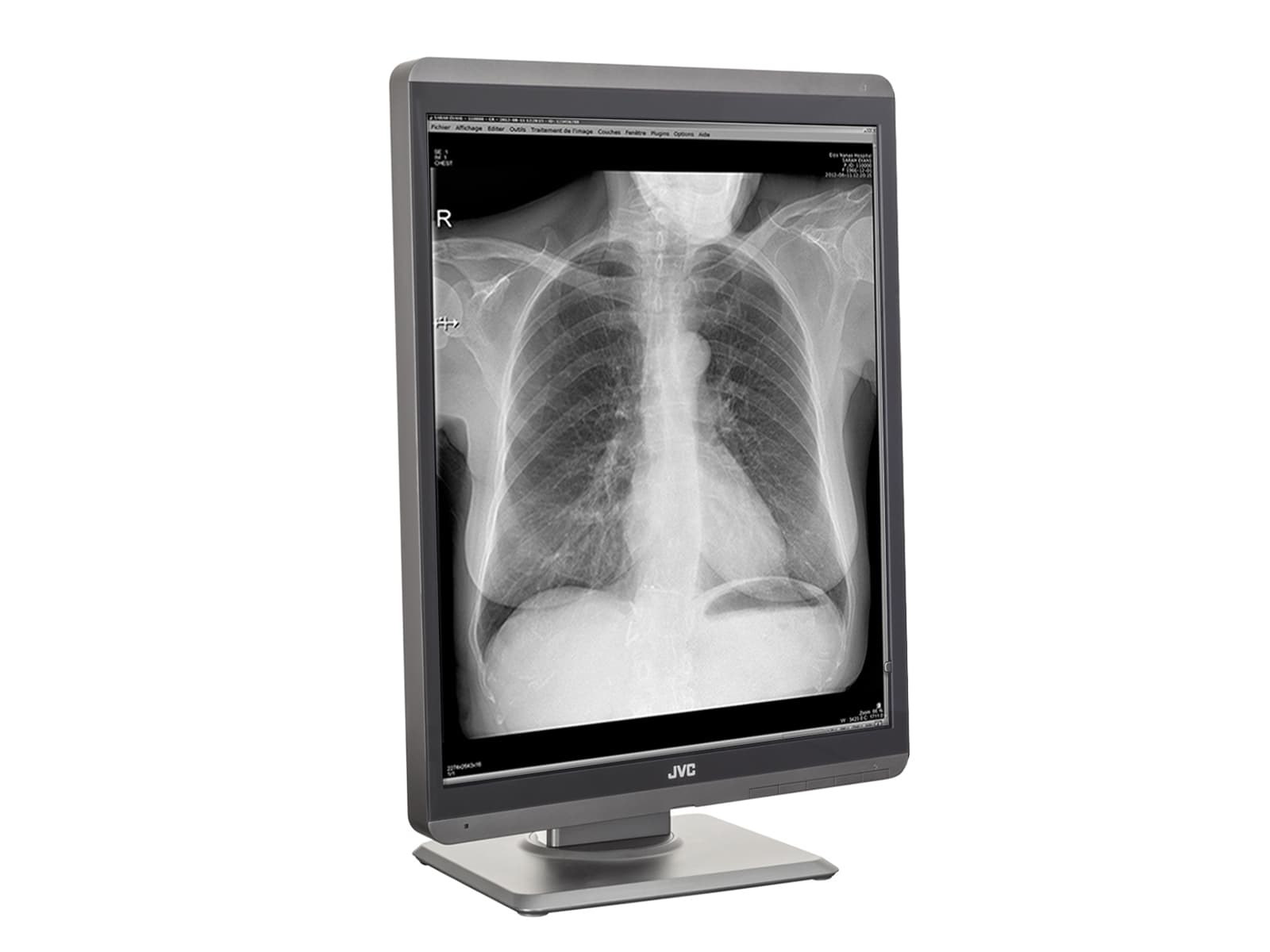 Monitor Médico JVC MS-S300 3MP – 21.3" – Escala de grises – Radiología Diagnóstica DICOM (5)