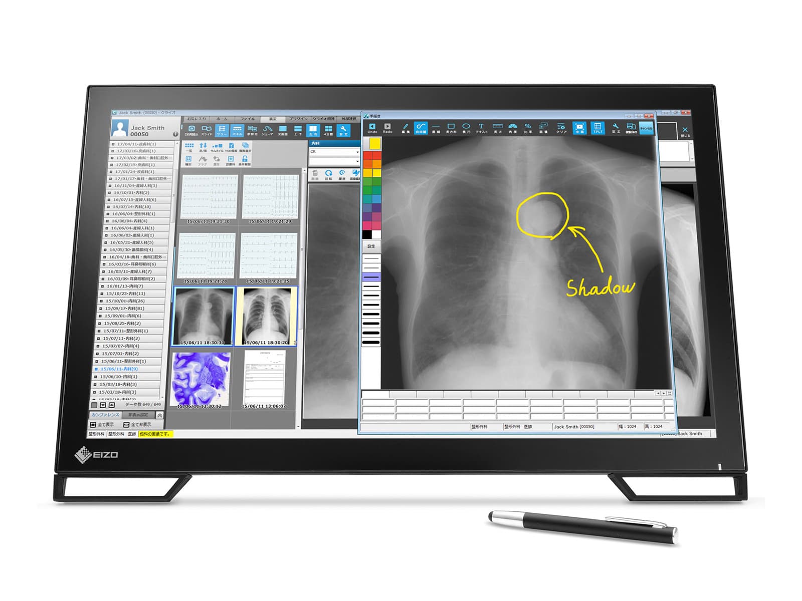 Monitor Médico Eizo MS236WT 2MP – 23" – Color – Revisión Clínica DICOM (1)