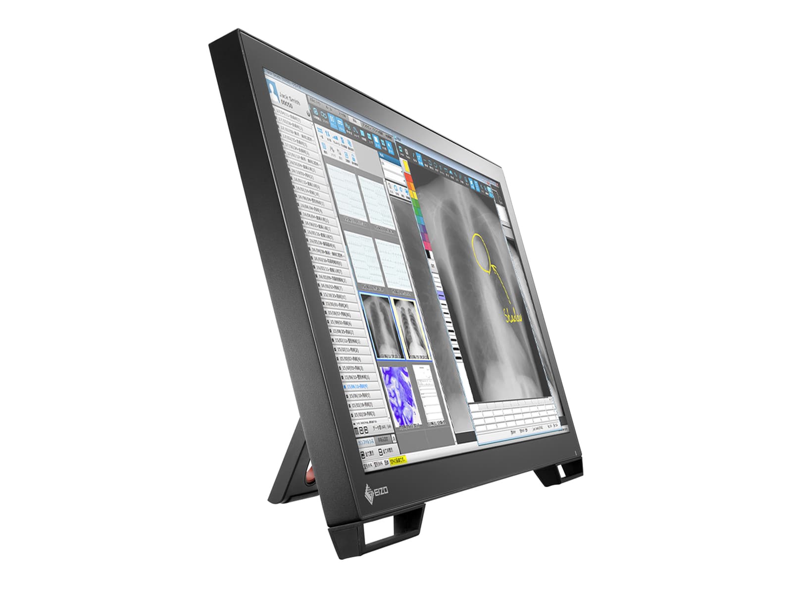 Monitor Médico Eizo MS236WT 2MP – 23" – Color – Revisión Clínica DICOM (2)
