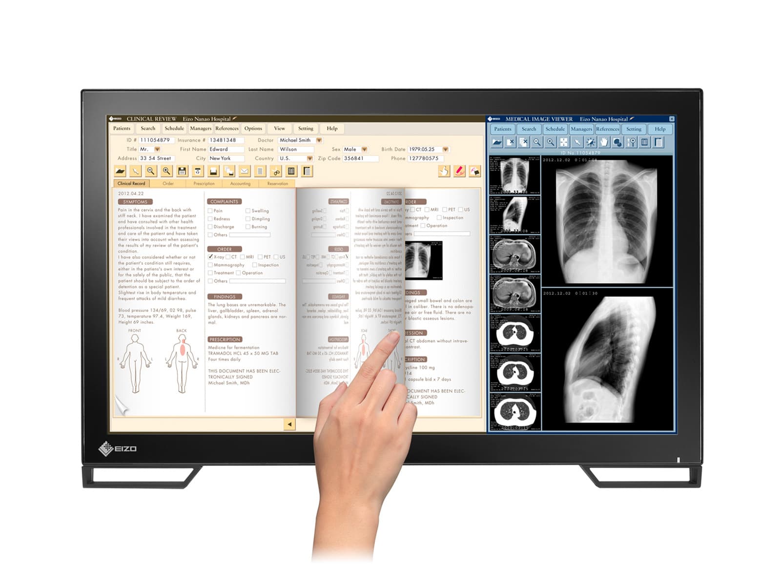 Monitor Médico Eizo MS236WT 2MP – 23" – Color – Revisión Clínica DICOM (6)