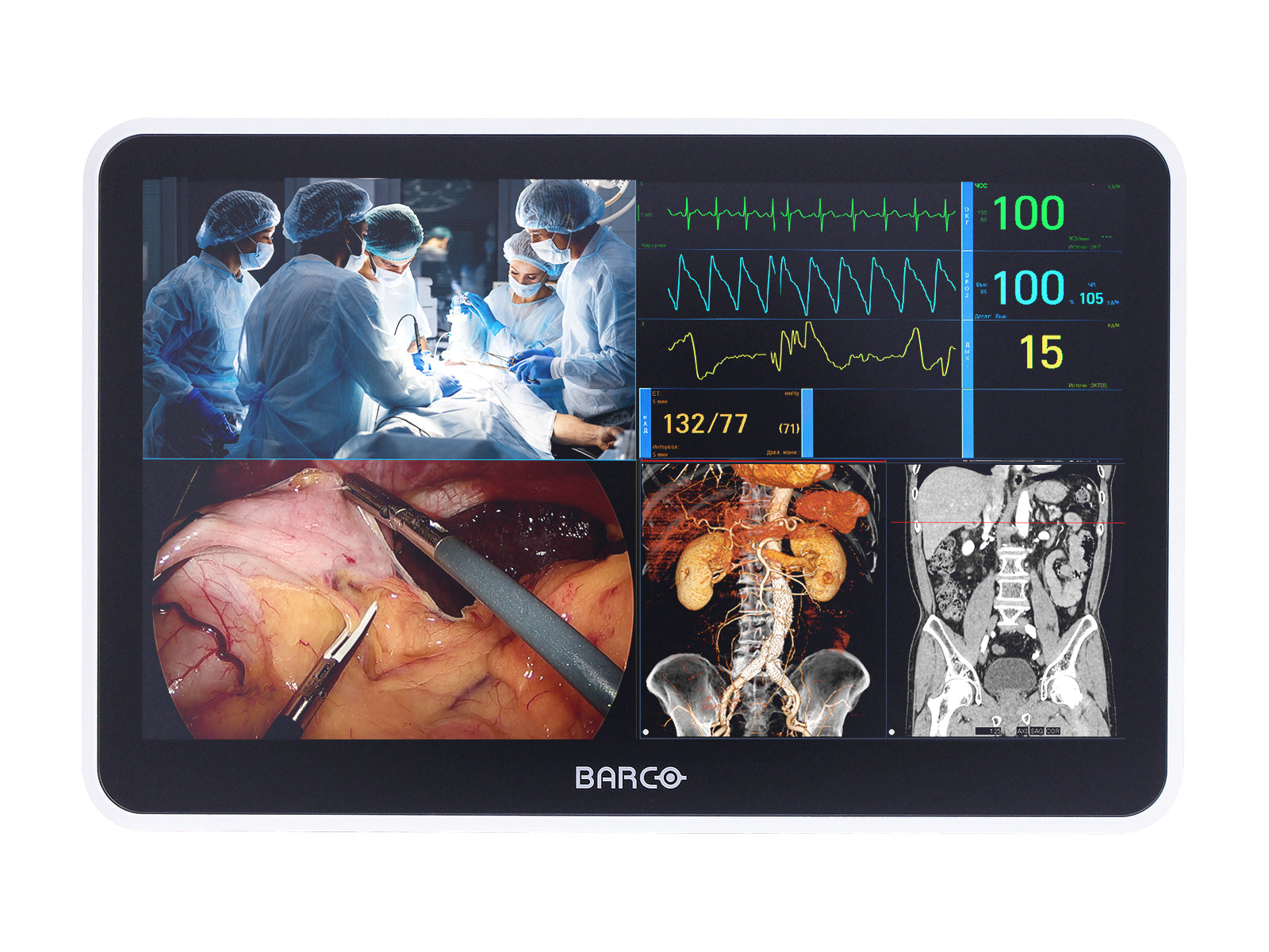 Monitor Médico Barco MUIP-2112 12.5" – Color – Revisión Clínica (1)