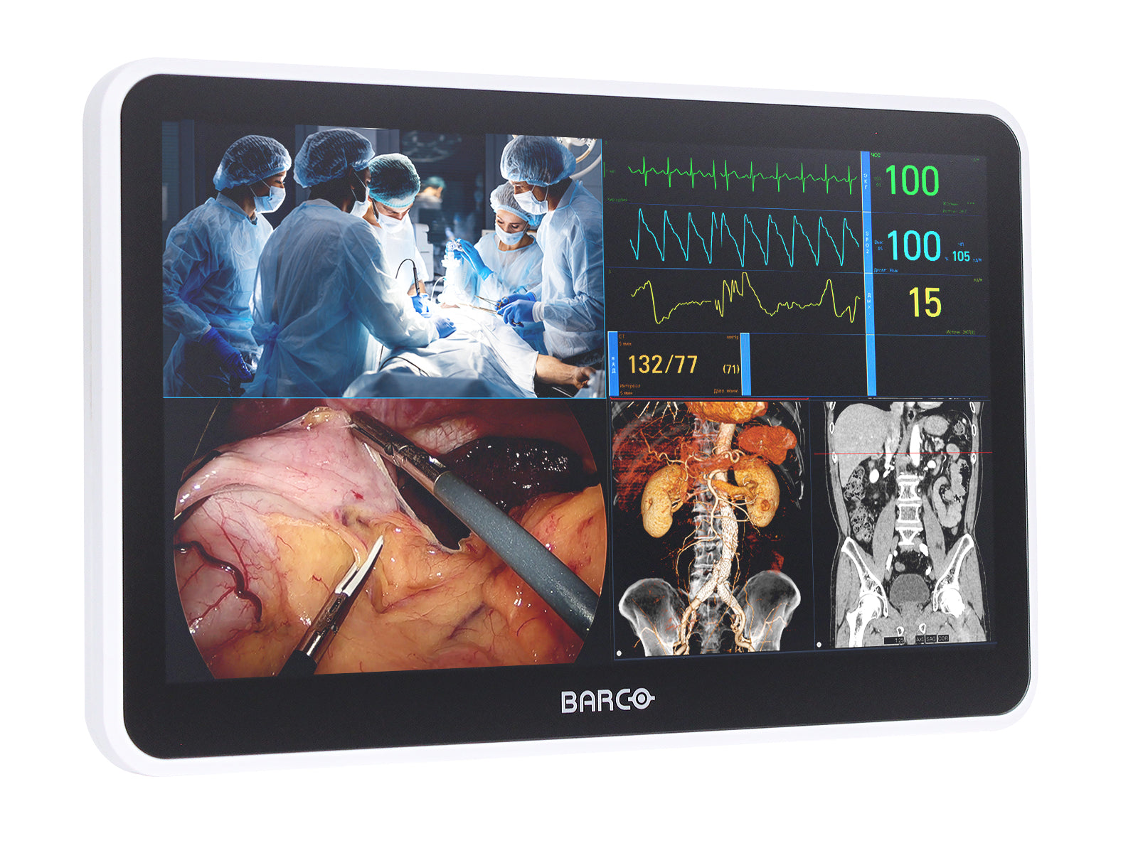 Monitor Médico Barco MUIP-2112 12.5" – Color – Revisión Clínica (2)