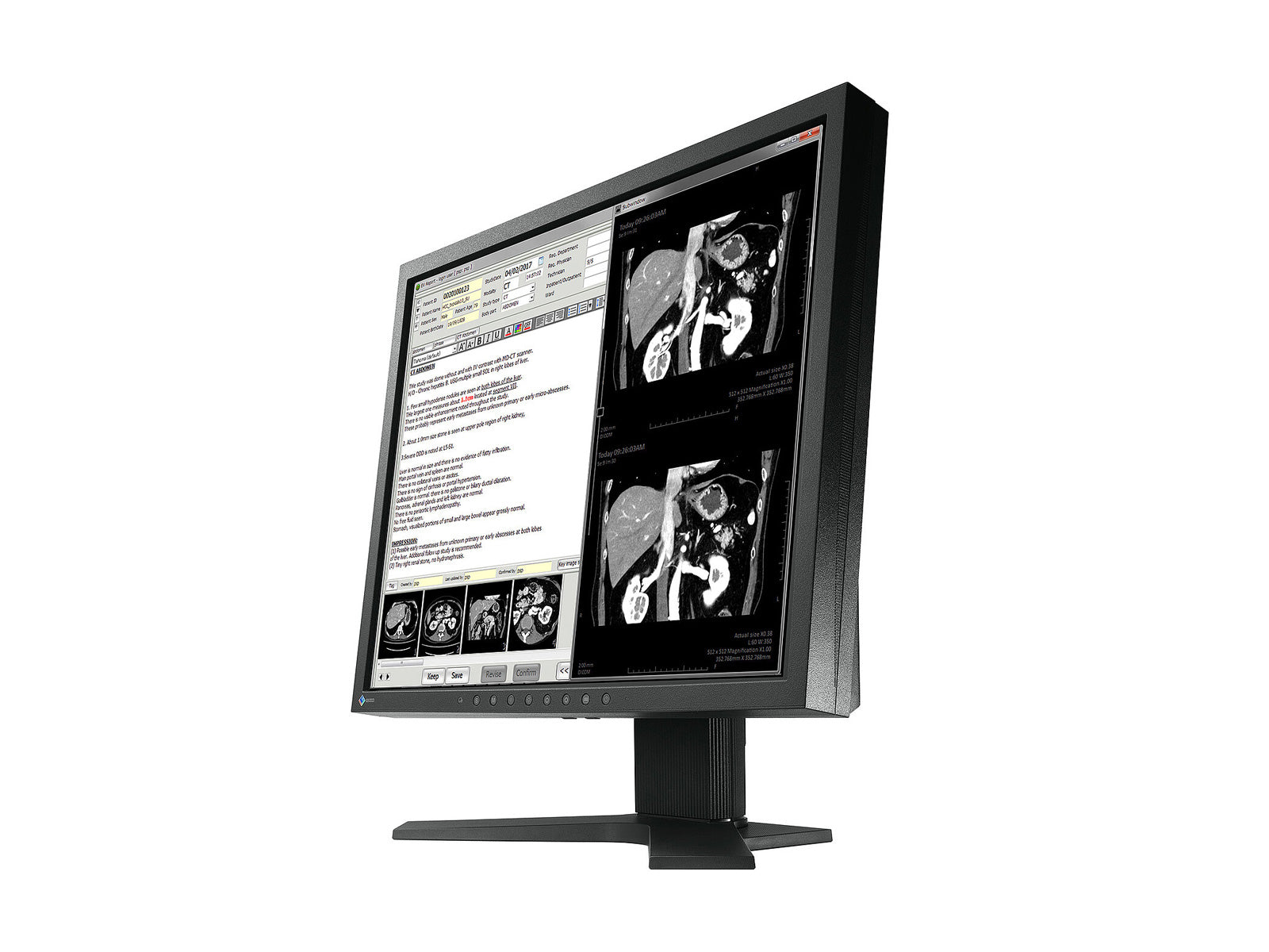 Monitor Médico Eizo MX194 1MP – 19" – Revisión Clínica DICOM (2)