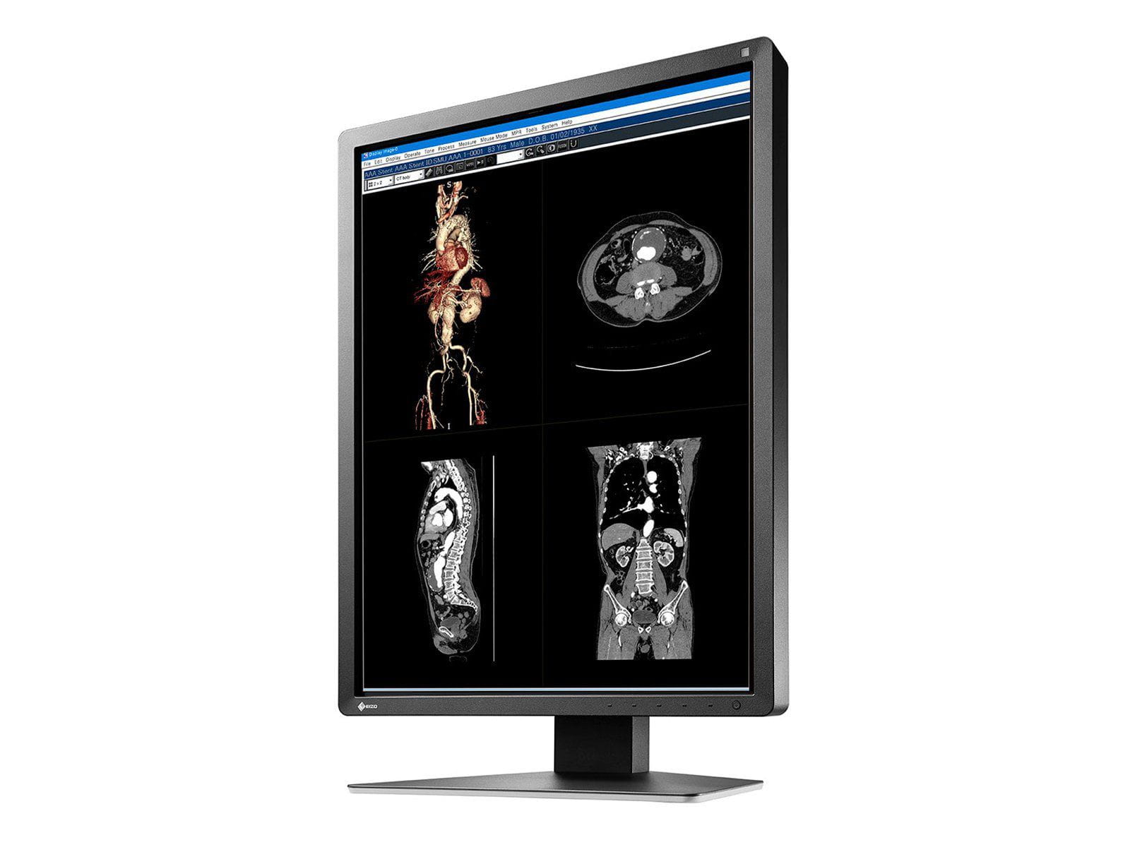 Monitor Médico Eizo MX216-BK 2MP – 21" – Color – Radiología Diagnóstica DICOM (4)