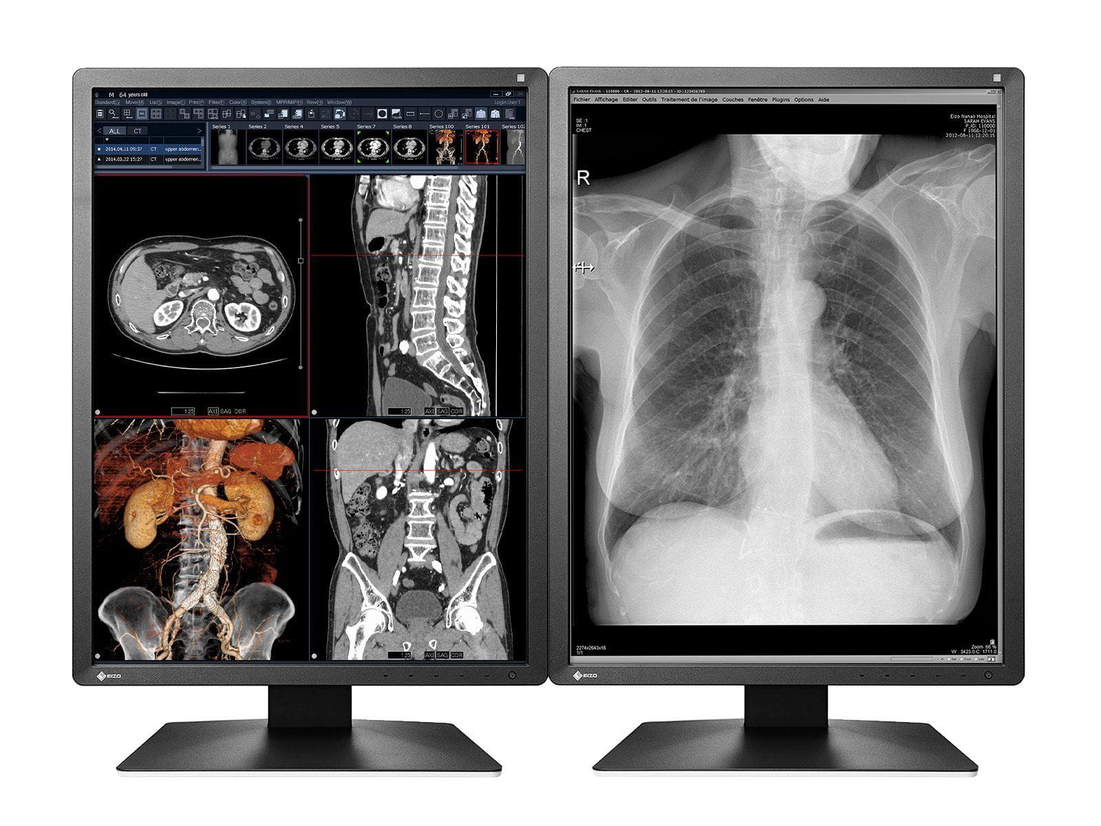 Monitor Médico Eizo MX216-BK 2MP – 21" – Color – Radiología Diagnóstica DICOM (1)
