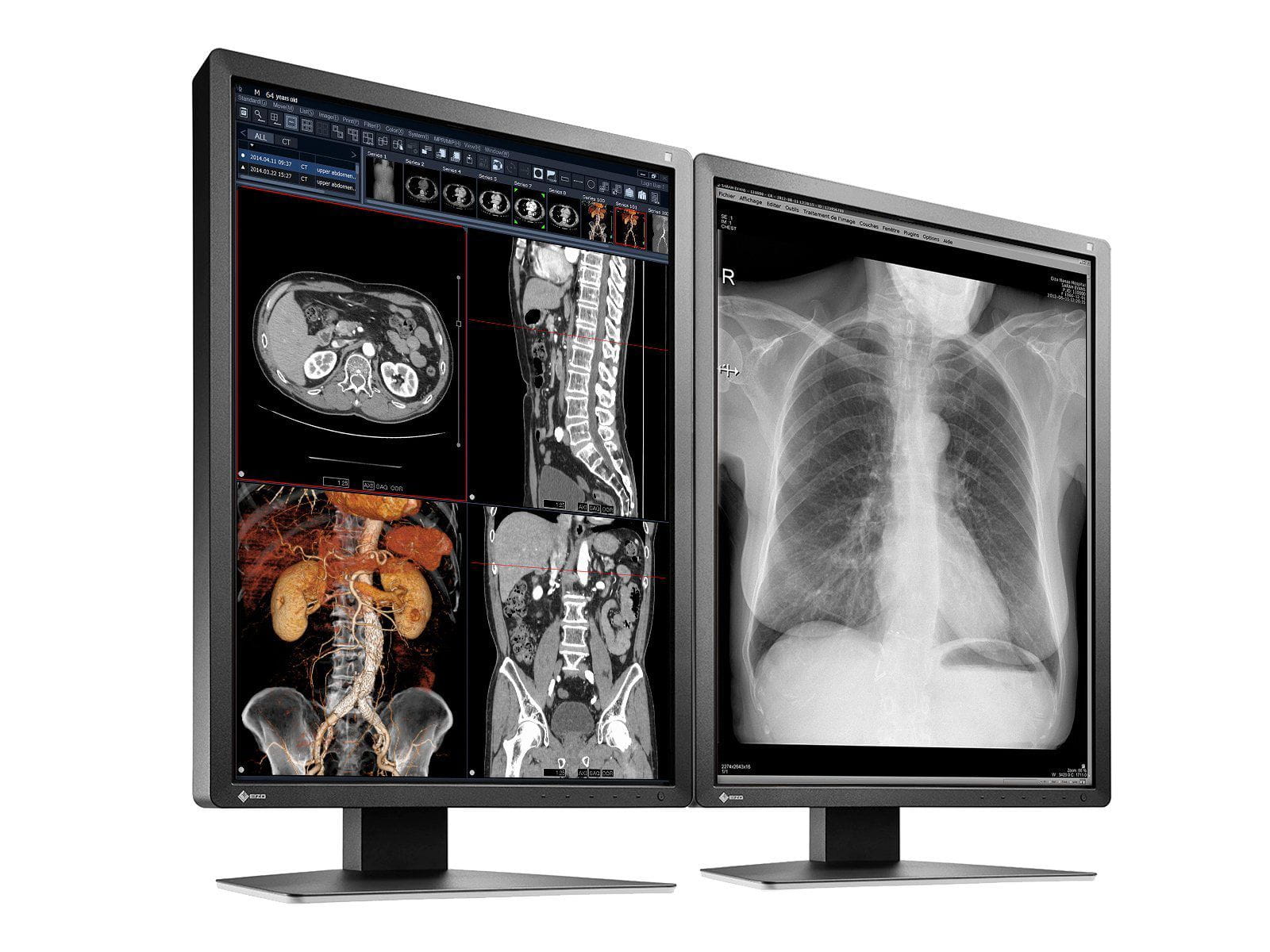 Monitor Médico Eizo MX216-BK 2MP – 21" – Color – Radiología Diagnóstica DICOM (2)