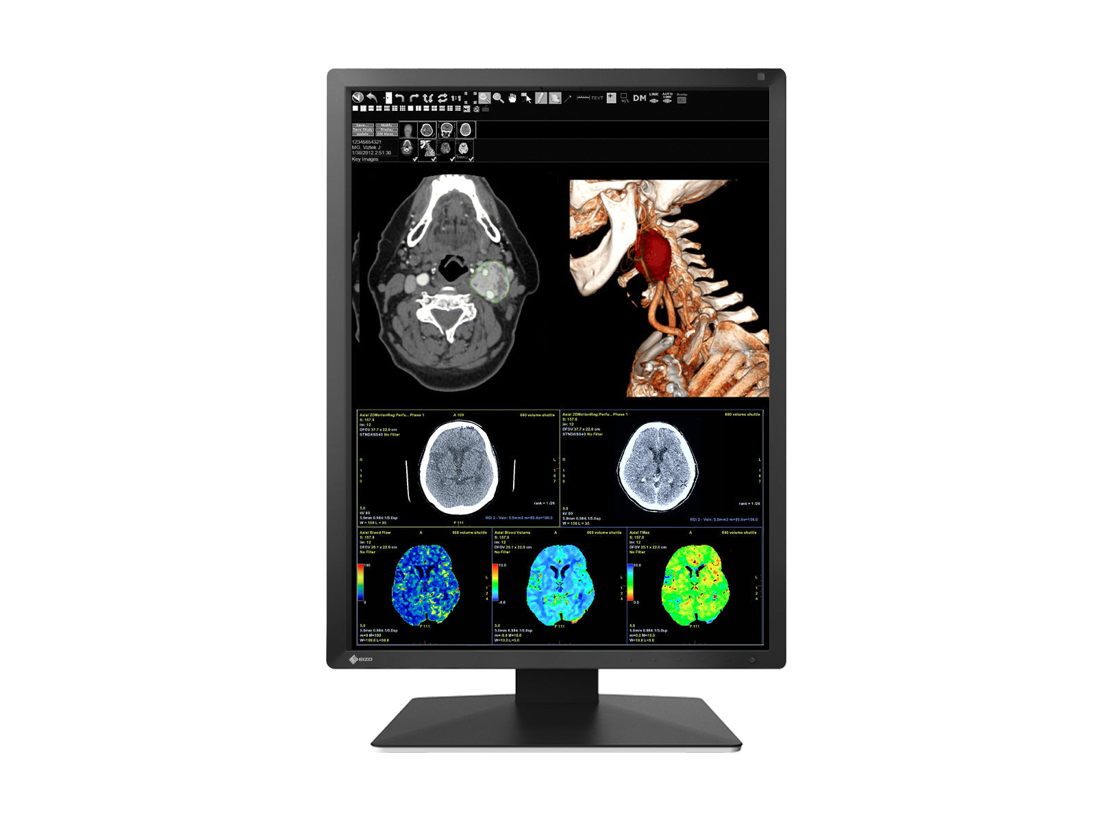 Monitor Médico Eizo MX217-BK 2MP – 21" – Color – Radiología Diagnóstica DICOM (3)