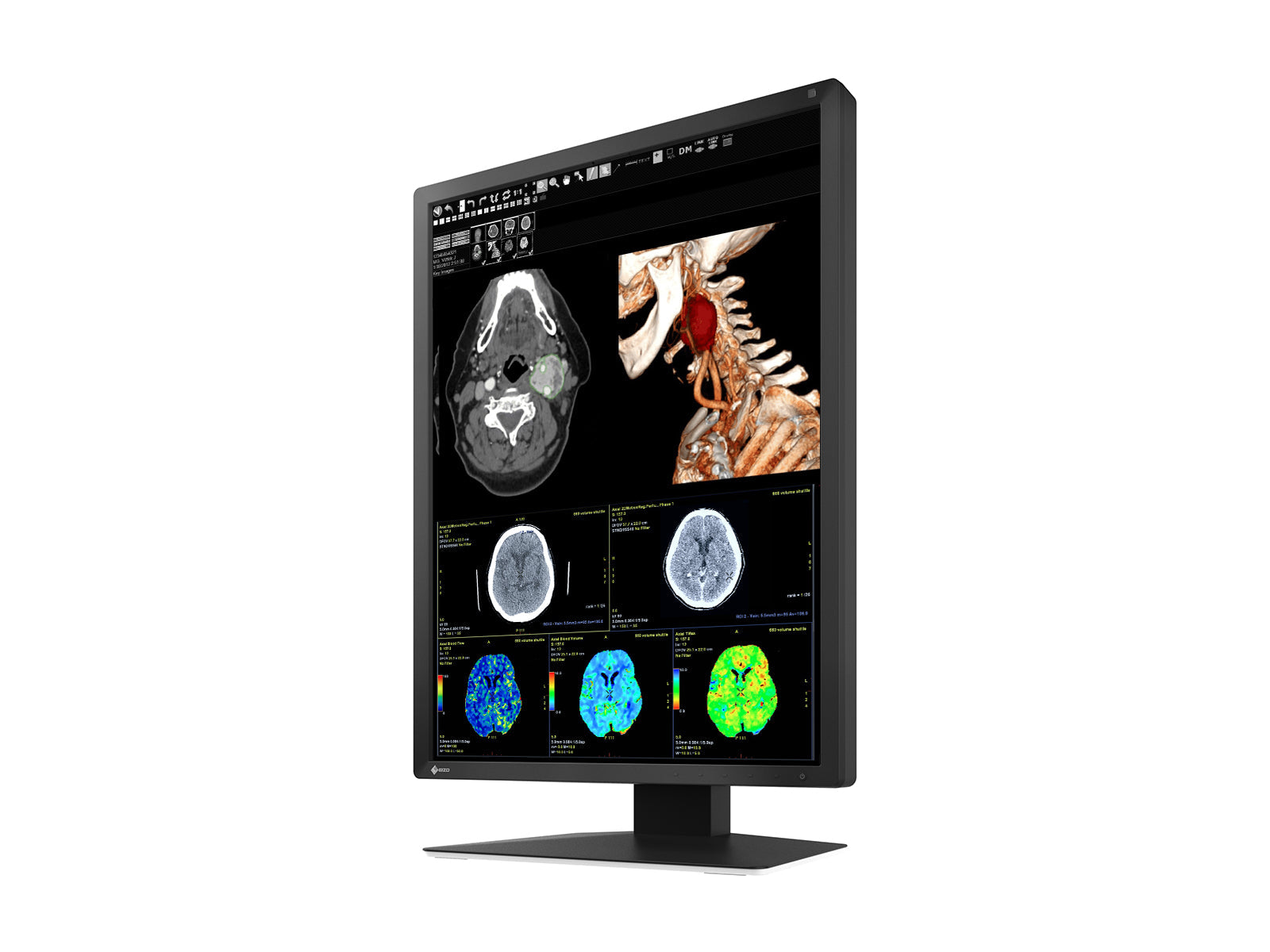 Monitor Médico Eizo MX217-BK 2MP – 21" – Color – Radiología Diagnóstica DICOM (4)