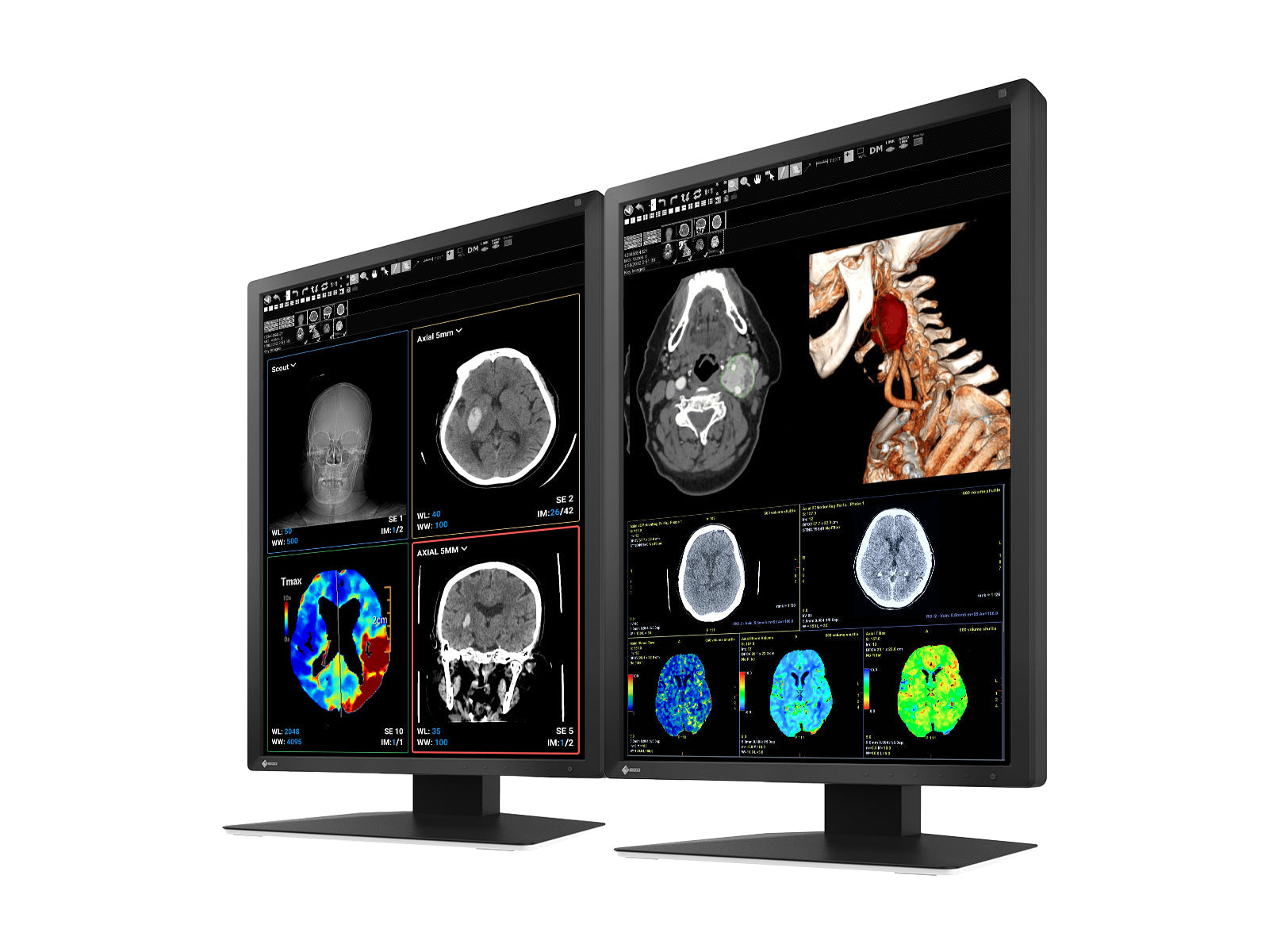 Monitor Médico Eizo MX217-BK 2MP – 21" – Color – Radiología Diagnóstica DICOM (2)