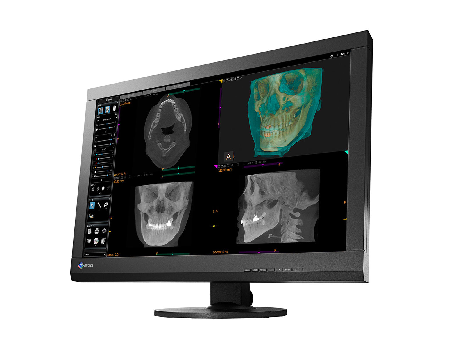 Monitor Médico Eizo MX242W-BK 2.3MP – 24" – Color – Revisión Clínica DICOM (2)