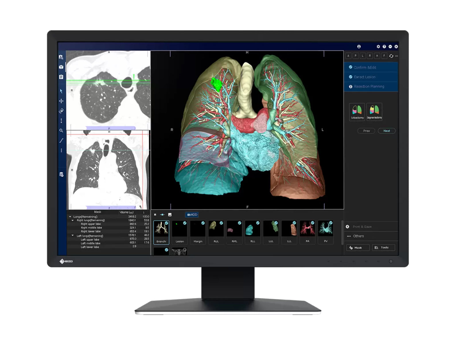 Monitor Médico Eizo MX243W 2.3MP – 24" – Color – Revisión Clínica DICOM (1)