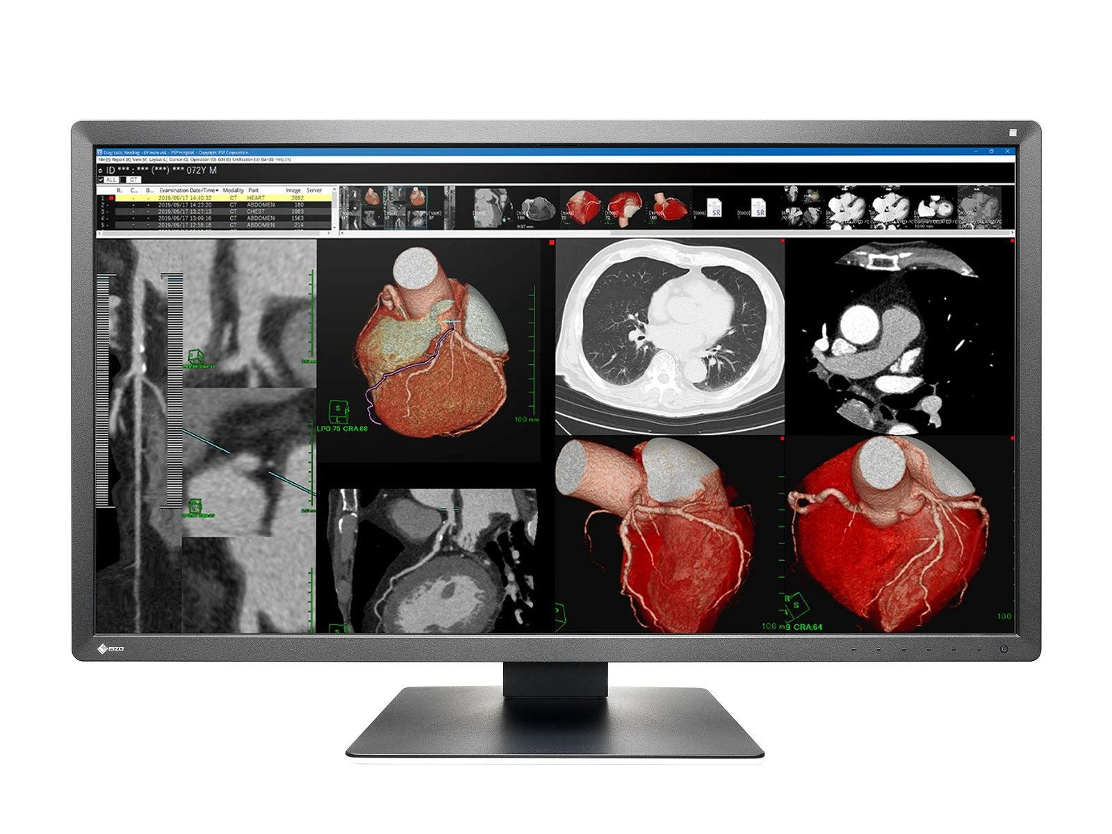 Monitor Médico Eizo MX317W-BK 8MP – 30.5" – Color – Radiología Diagnóstica DICOM (1)