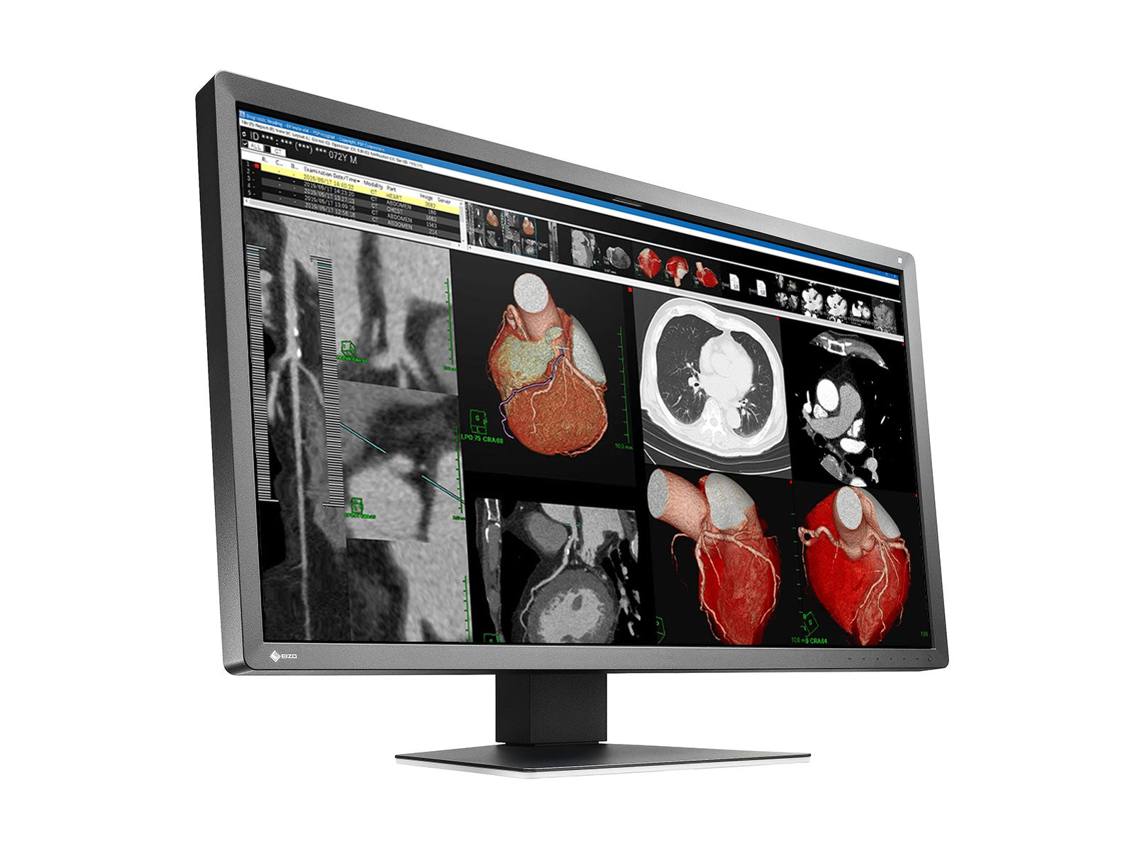 Monitor Médico Eizo MX317W-BK 8MP – 30.5" – Color – Radiología Diagnóstica DICOM (2)