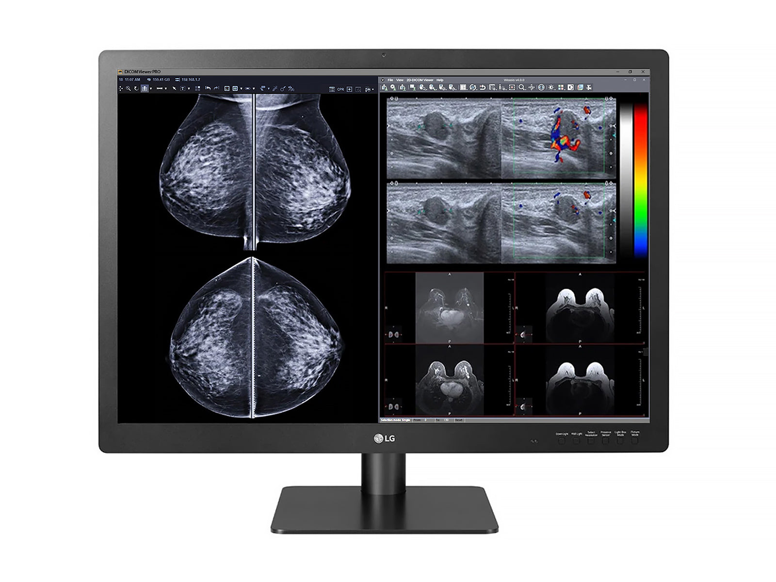 Monitor Médico LG 31HN713D-B 12MP – 31.5" – Color – Radiología Diagnóstica DICOM (1)
