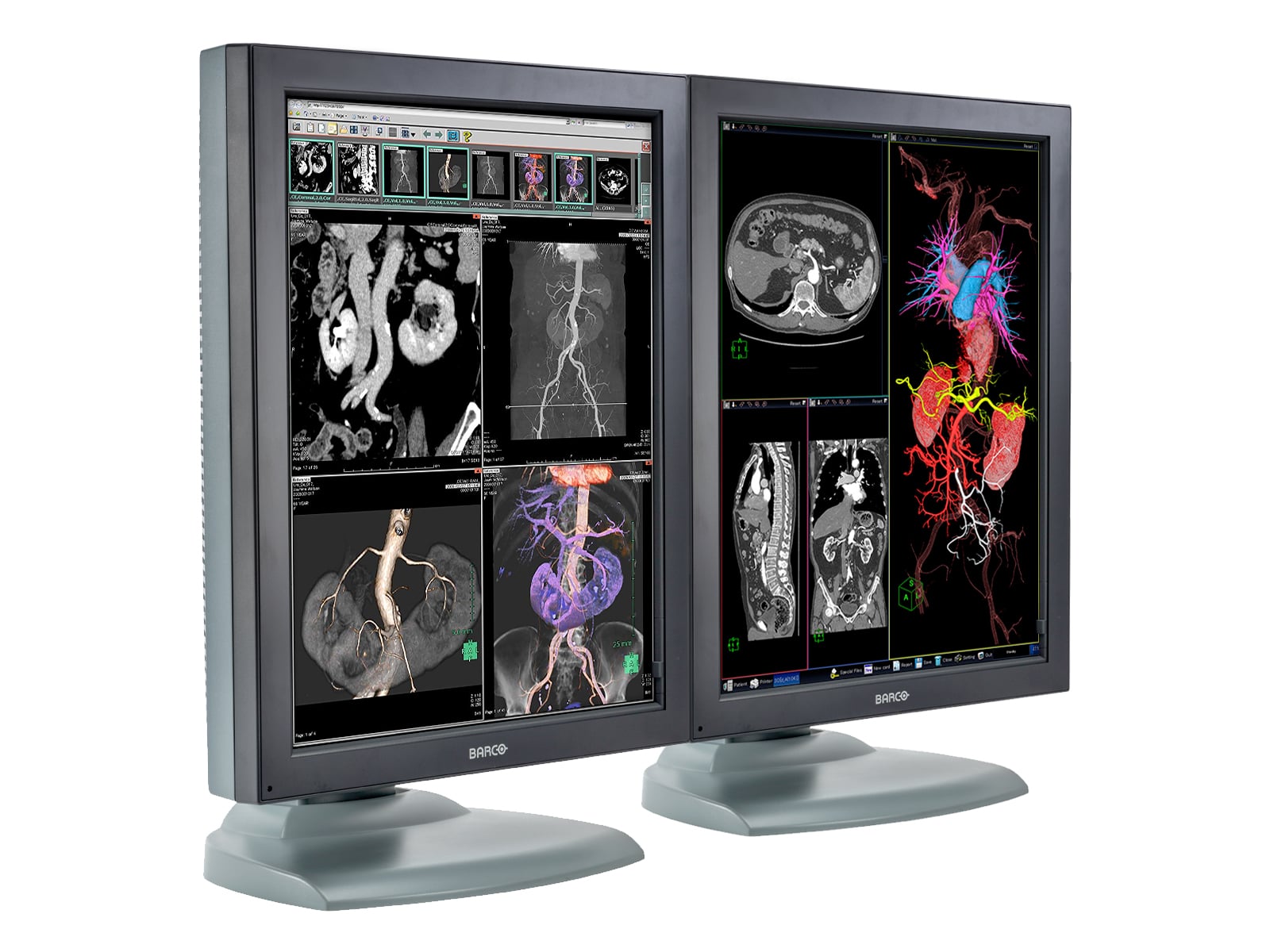 Monitor Médico Barco MDNC-3121 3MP – 21" – Color – Radiología Diagnóstica DICOM (2)
